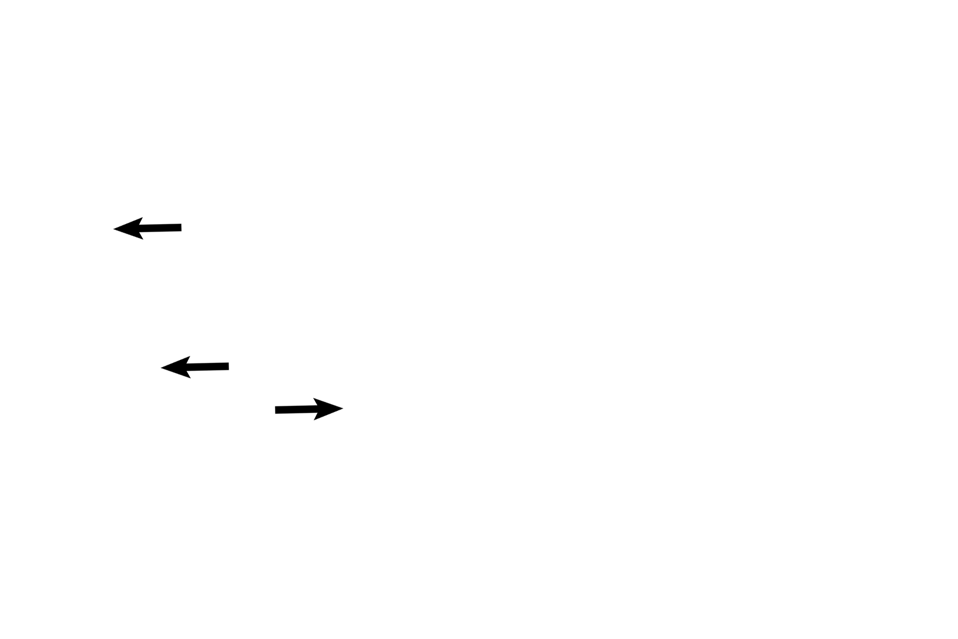 Connective tissue reticulum > <p>Connective tissue cells that appear scattered in the perilymph around the outside of the ampulla are part of the connective tissue reticulum that secures the membranous labyrinth in the osseous labyrinth.</p>
