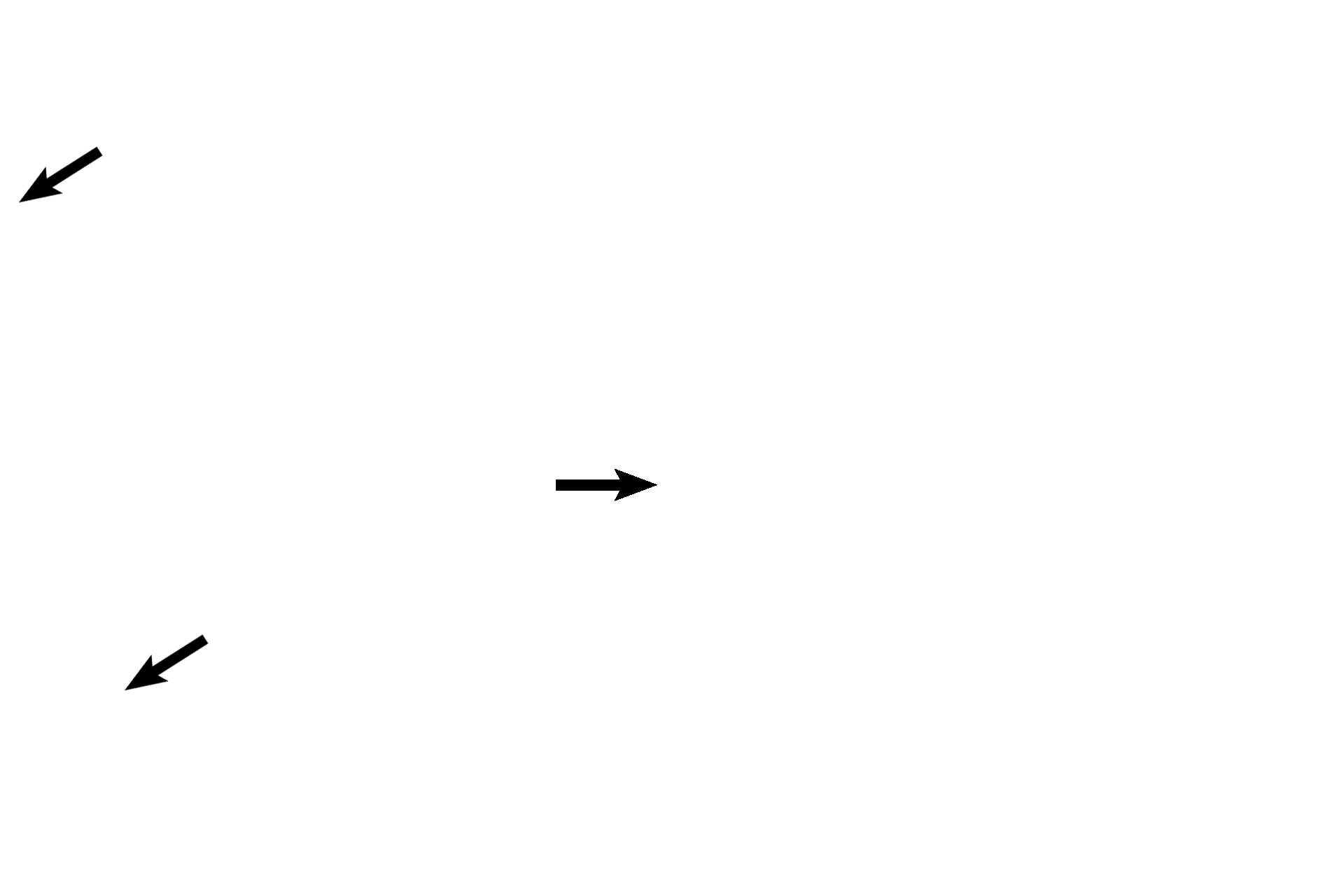 Temporal bone > <p>The temporal bone comprises the wall of the spaces forming the osseous labyrinth.</p>
