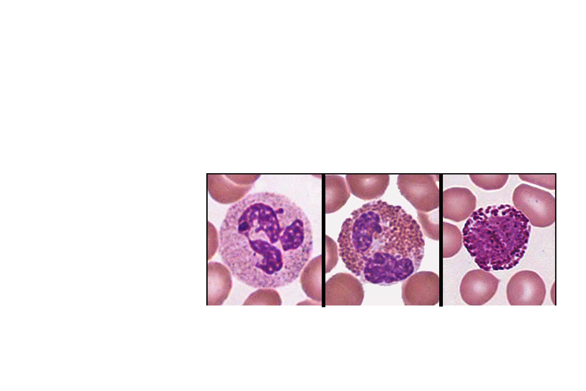 Azurophilic and specific granules > <p>Azurophilic granules, lysosomes, are a nonspecific, generic type of granule that is present in all granulocytes, monocytes and platelets; whereas, specific granules are unique to a single cell line. Thus, neutrophilic myelocytes possess specific granules that are only present in neutrophils. Eosinophils and basophils also have their own unique specific granules. Azurophilic granules are only produced by promyelocytes.</p>
