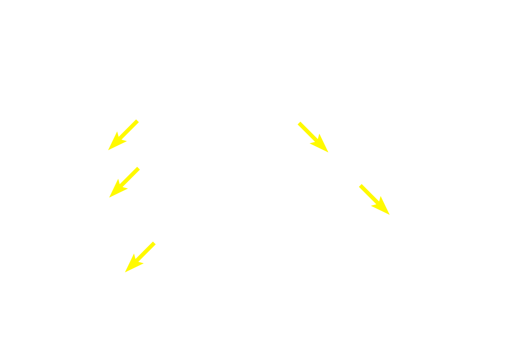 Goblet cells <p>The simplest gland is a unicellular gland, which can be either endocrine or exocrine.  The goblet cells shown here represent unicellular exocrine glands that remain in the epithelium from which they originated.  These cells secrete mucus and are prominent in the lining epithelium of the gastrointestinal and respiratory systems.  Small intestine  400x</p>
