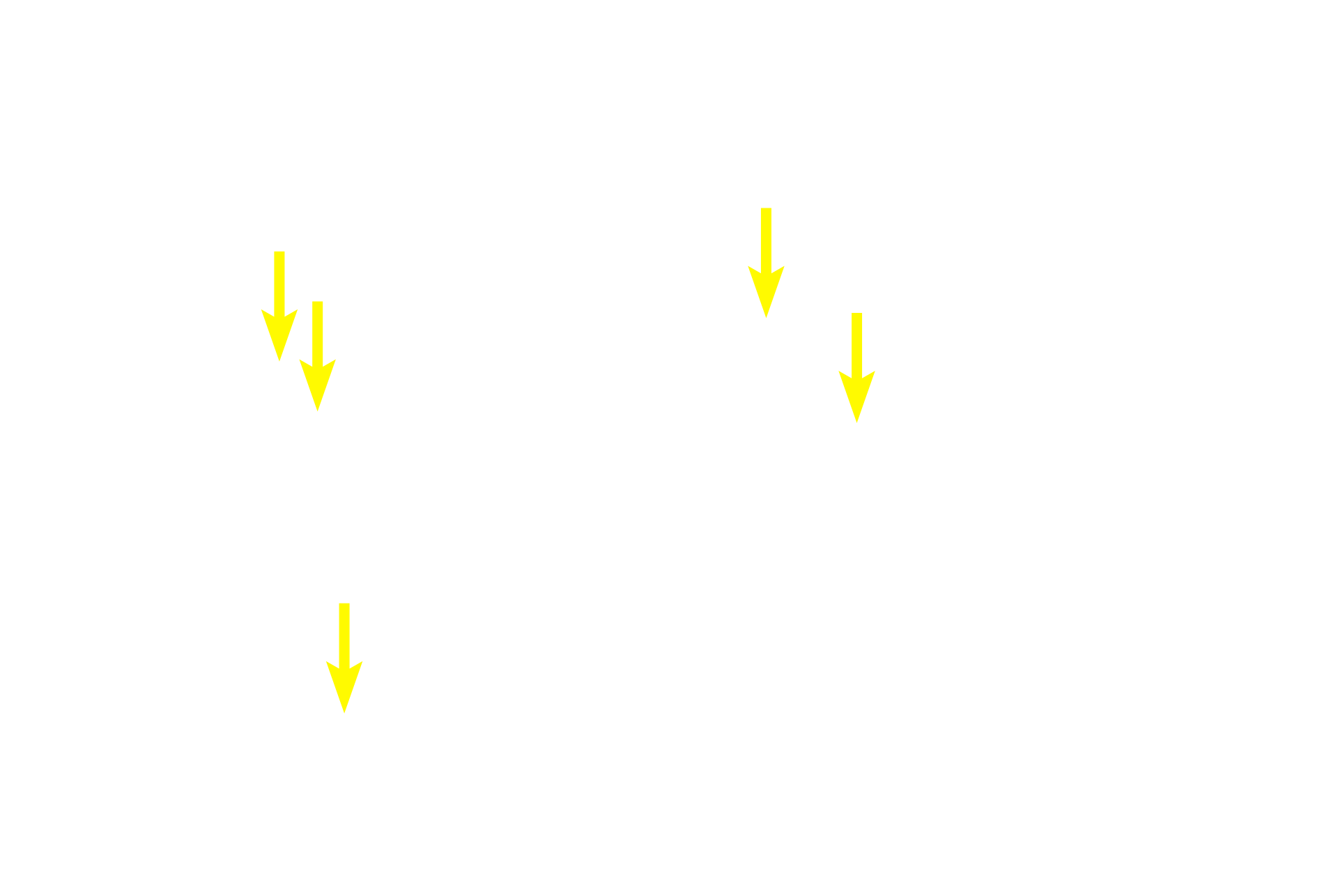  - Goblet cell nuclei <p>The simplest gland is a unicellular gland, which can be either endocrine or exocrine.  The goblet cells shown here represent unicellular exocrine glands that remain in the epithelium from which they originated.  These cells secrete mucus and are prominent in the lining epithelium of the gastrointestinal and respiratory systems.  Small intestine  400x</p>
