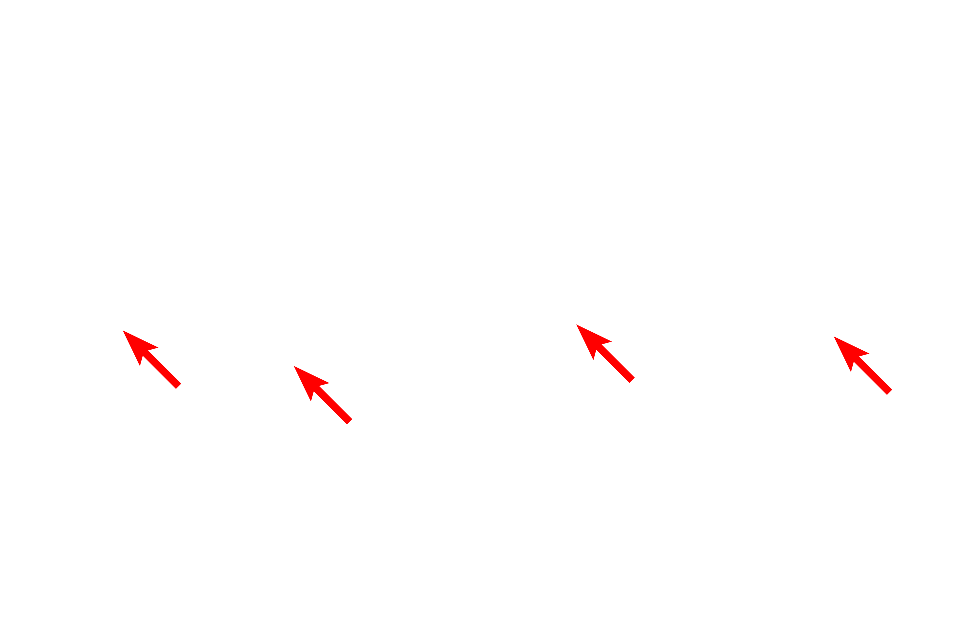  -- Lamina densa <p>This electron micrograph shows the basement membrane with its two components, the basal lamina and the reticular lamina. The basal lamina is, in turn, subdivided into the lamina lucida and the lamina densa.  The reticular lamina lies beneath the basal lamina and is composed of loose connective tissue with type III collagen fibrils.  Anchoring fibrils extend from the lamina densa and loop around the type III collagen fibrils serving to attach the basal lamina to the underlying loose connective tissue of the reticular lamina. Capillary 45,000x.</p>
