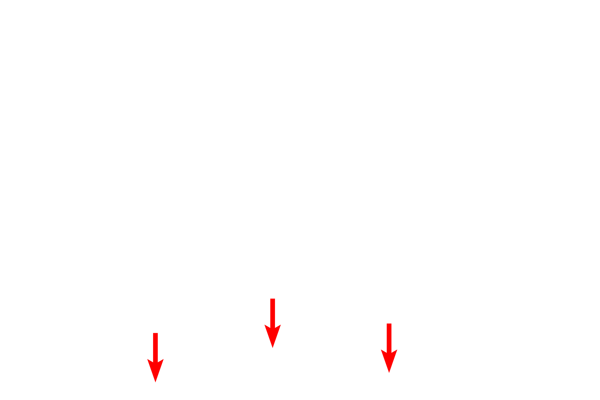 Collagen fibrils <p>This electron micrograph shows the basement membrane with its two components, the basal lamina and the reticular lamina. The basal lamina is, in turn, subdivided into the lamina lucida and the lamina densa.  The reticular lamina lies beneath the basal lamina and is composed of loose connective tissue with type III collagen fibrils.  Anchoring fibrils extend from the lamina densa and loop around the type III collagen fibrils serving to attach the basal lamina to the underlying loose connective tissue of the reticular lamina. Capillary 45,000x.</p>
