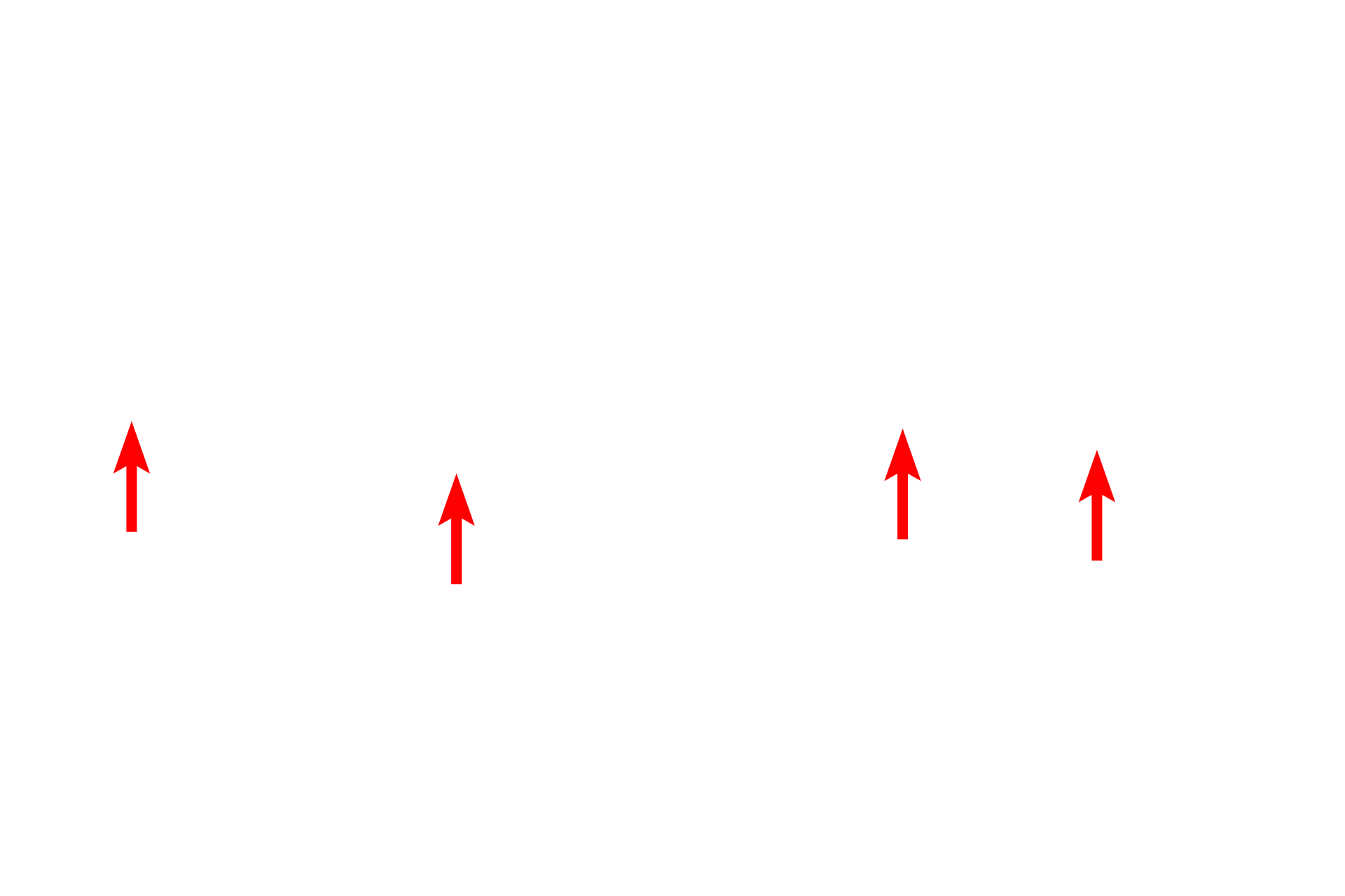 Epithelial cell membrane <p>This electron micrograph shows the basement membrane with its two components, the basal lamina and the reticular lamina. The basal lamina is, in turn, subdivided into the lamina lucida and the lamina densa.  The reticular lamina lies beneath the basal lamina and is composed of loose connective tissue with type III collagen fibrils.  Anchoring fibrils extend from the lamina densa and loop around the type III collagen fibrils serving to attach the basal lamina to the underlying loose connective tissue of the reticular lamina. Capillary 45,000x.</p>

