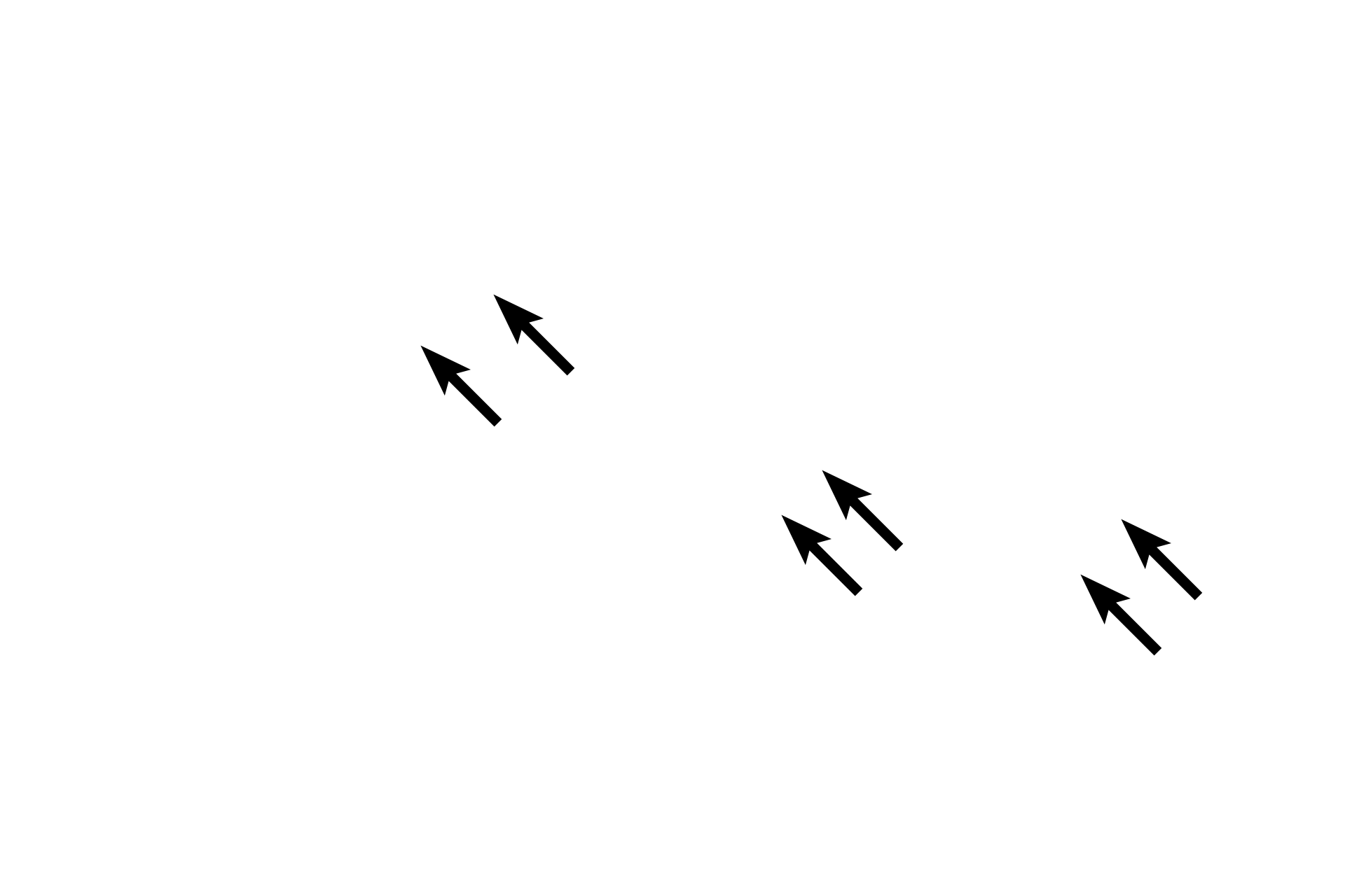 Myelin sheaths > <p>A myelin sheath surrounds an individual axon and consists of myelin segments (internodes) arranged linearly along the axon.  Each internode is produced by the spiral wrapping of the Schwann cell plasma membrane around the axon.  The uniquely high lipid content of the myelin membrane insulates the axon and increases conduction velocity.  The radial lines in the sheath are proteinaceous remnants of the plasma membrane.  Endoneurium surrounds the Schwann cells.</p>
