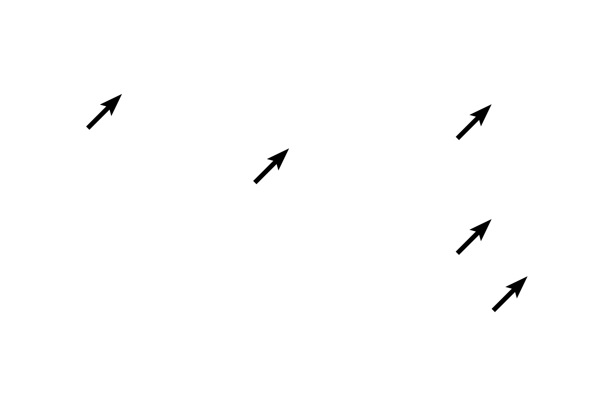 Endoneurium <p>A myelin sheath surrounds an individual axon and consists of myelin segments (internodes) arranged linearly along the axon.  Each internode is produced by the spiral wrapping of the Schwann cell plasma membrane around the axon.  The uniquely high lipid content of the myelin membrane insulates the axon and increases conduction velocity.  The radial lines in the sheath are proteinaceous remnants of the plasma membrane.  Endoneurium surrounds the Schwann cells.</p>
