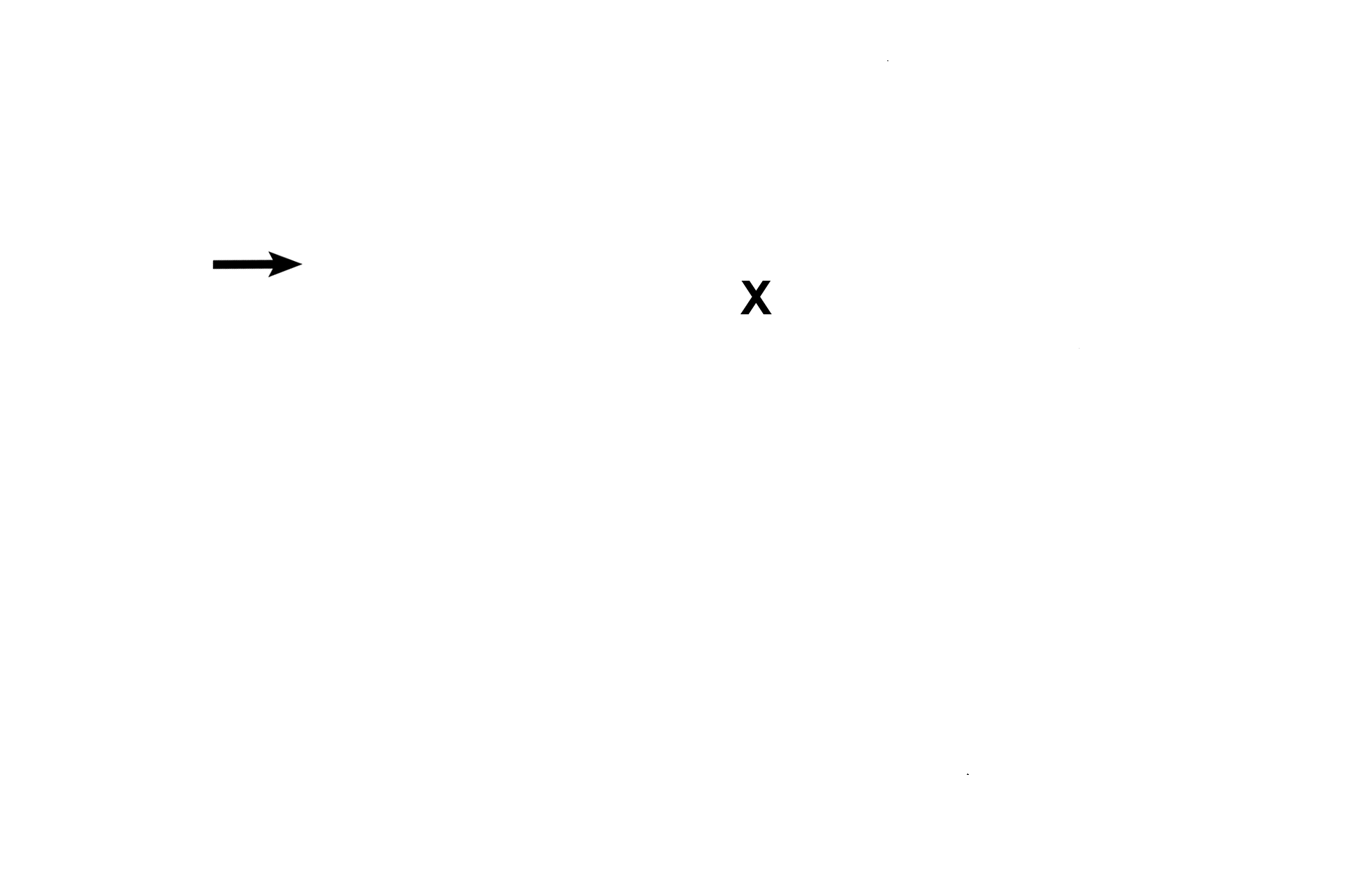  - Saccule <p>The vestibule, a portion of the osseous labyrinth, houses the utricle and saccule, portions of the membranous labyrinth. Receptors in the utricle and saccule, the maculae, respond to linear acceleration and gravitational forces.</p>
