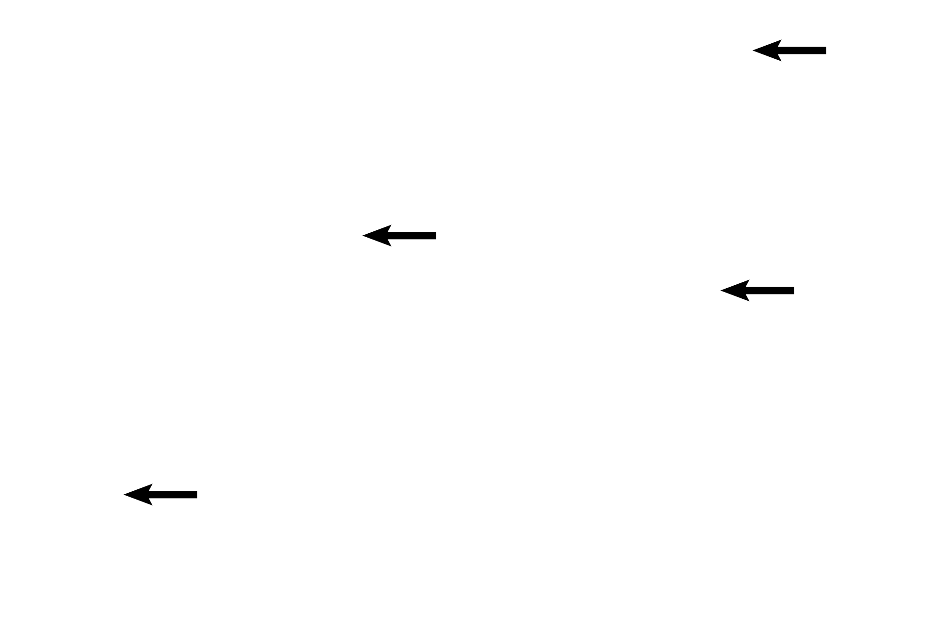 Interlobular connective tissue <p>The lactating stage of the breast is characterized by the large amount of glandular parenchyma relative to the connective tissue and by the presence of widely distended acini. Different lobules of the breast are in different stages of milk production and release. The acini and ducts are filled with milk. 100x </p>

