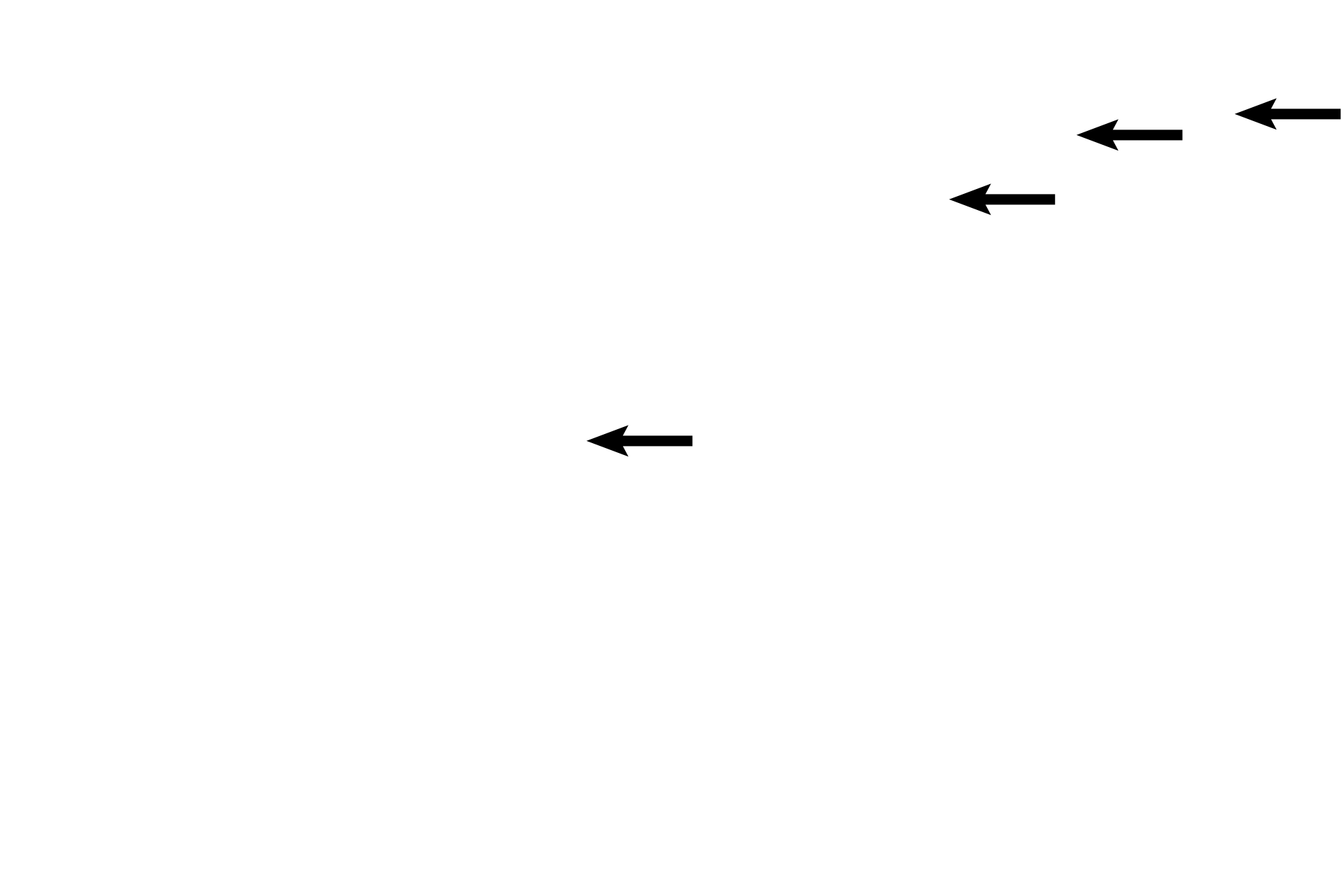  - Interlobular ducts <p>The lactating stage of the breast is characterized by the large amount of glandular parenchyma relative to the connective tissue and by the presence of widely distended acini. Different lobules of the breast are in different stages of milk production and release. The acini and ducts are filled with milk. 100x </p>
