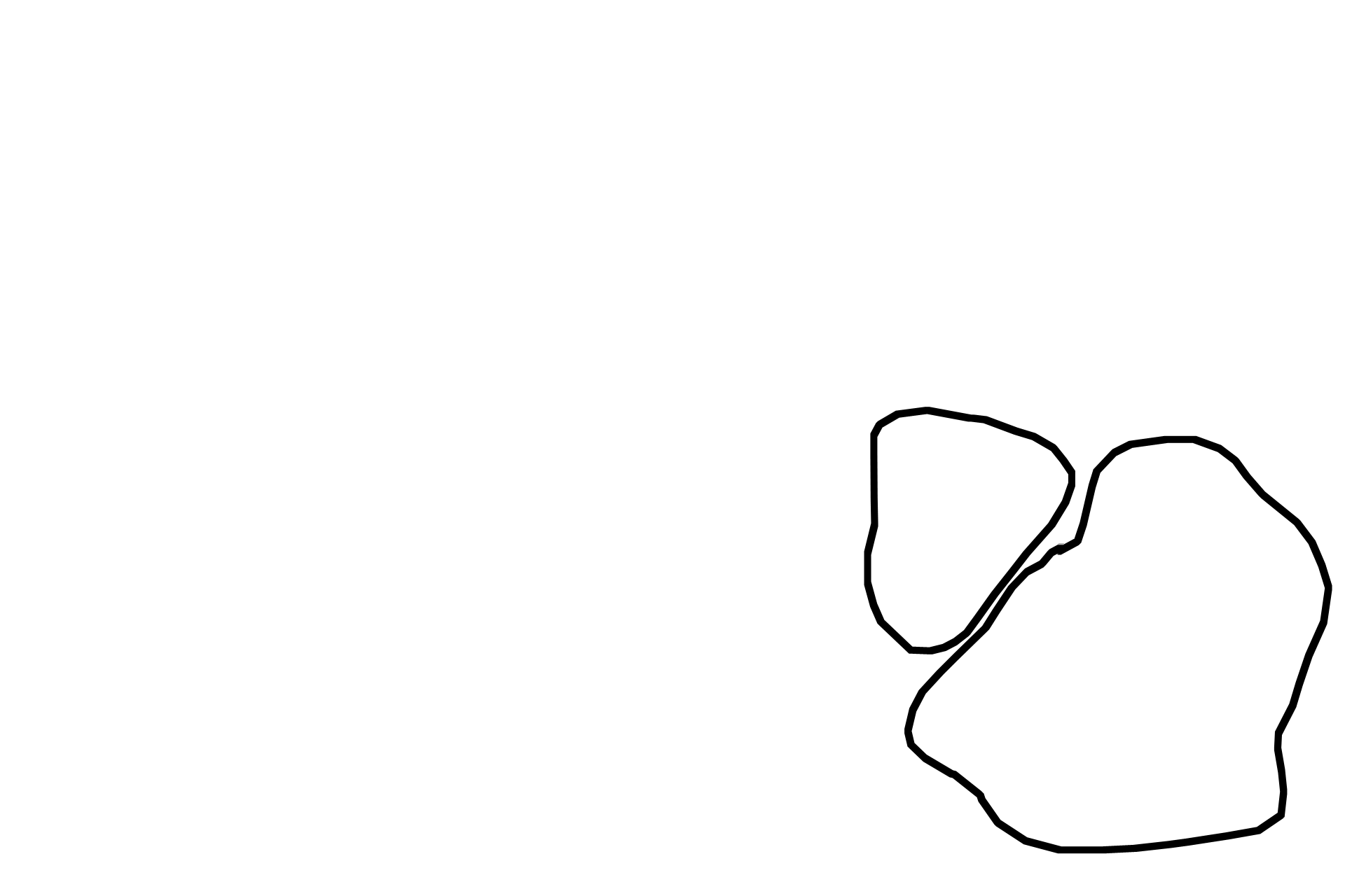  - Variation in activity <p>The lactating stage of the breast is characterized by the large amount of glandular parenchyma relative to the connective tissue and by the presence of widely distended acini. Different lobules of the breast are in different stages of milk production and release. The acini and ducts are filled with milk. 100x </p>
