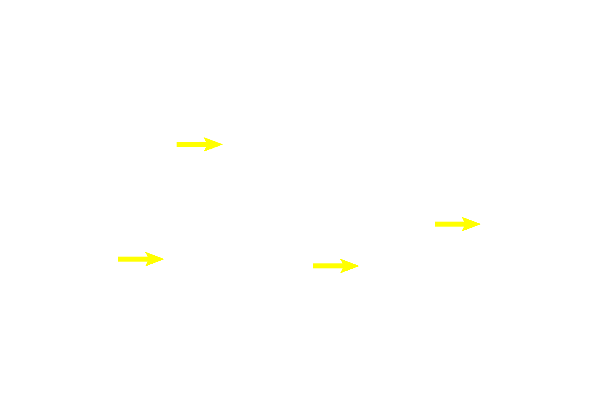  - Lipid droplets <p>Secretory cells of the breast secrete by both the merocrine (protein) and apocrine (lipid) modes of secretion. In the lower right of the field, secretory product is in the process of being released from the cells. The clear regions in the cytoplasm contain lipid. 1000x</p>
