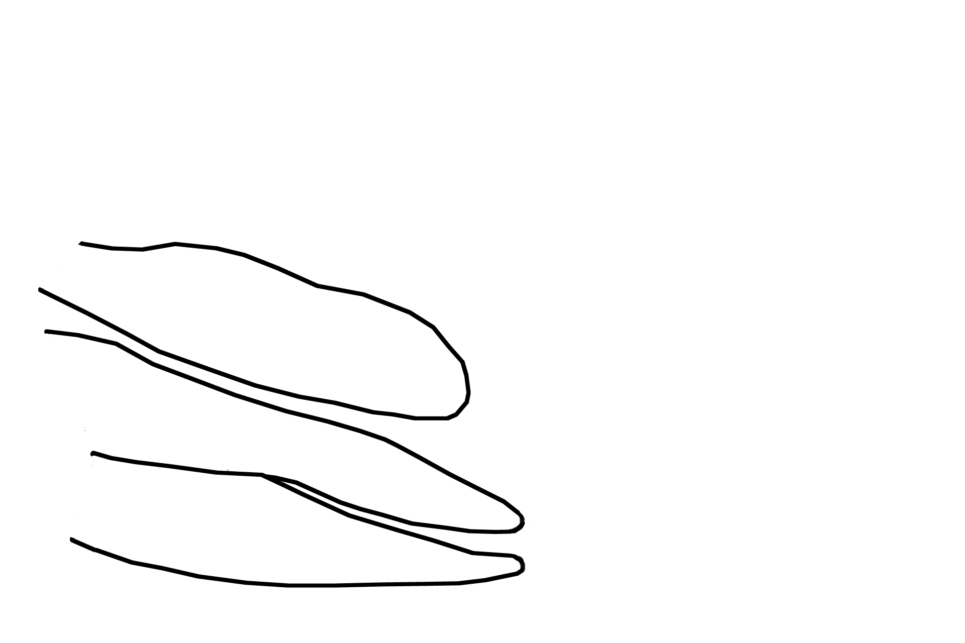  - Coni vasculosi <p>The efferent ducts are coiled into 12-20 cone-shaped structures, the coni vasculosi, composed of the efferent ducts, as well as the connective tissue and abundant vasculature surrounding them.  The apex of each cone faces the testis; each base faces the posterior surface of the epididymis.   </p>
