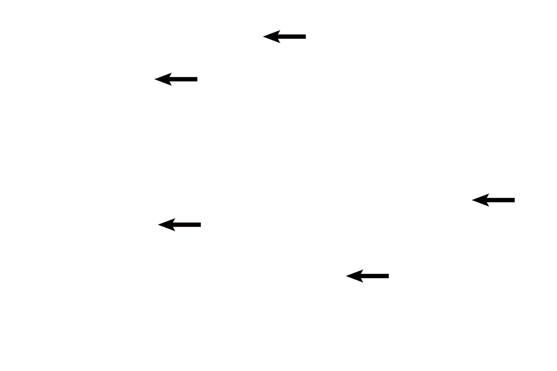 Prostatic concretions <p>Several individual prostate glands fill the image. The epithelium of the prostate, simple or pseudostratified columnar, and its underlying connective tissue are thrown into low folds. Prostatic concretions, probably precipitates of secretory products, accumulate with age and may calcify; concretions are diagnostic for the prostate. 300x</p>
