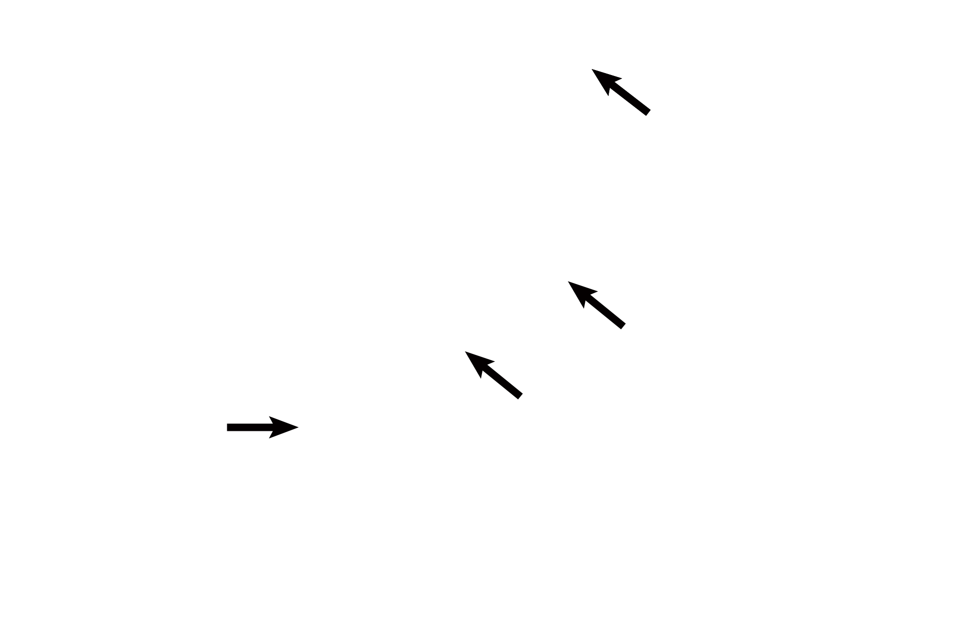  - Epithelium <p>Several glands are visible, each lined by simple or pseudostratified columnar epithelium. Prostatic concretions (corpora amylacea) are diagnostic for the prostate. They are probably precipitated secretory product, whose number increases with age. 400x</p>
