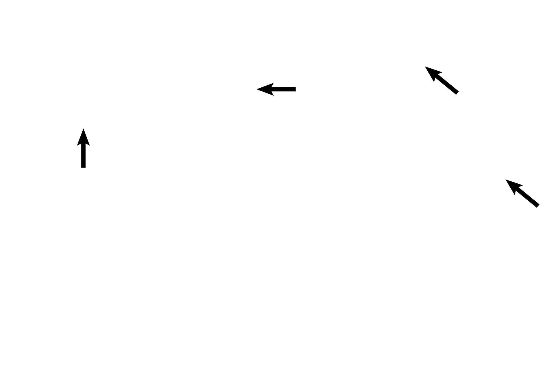  - Mucosal arcades <p>The single gland forming each seminal vesicle is highly convoluted, so a section through the gland reveals multiple profiles. The seminal vesicle is most easily identified by its central lumen that has been partitioned by the arcading of its mucosal folds. Smooth muscle surrounds the seminal vesicle. 40x</p>
