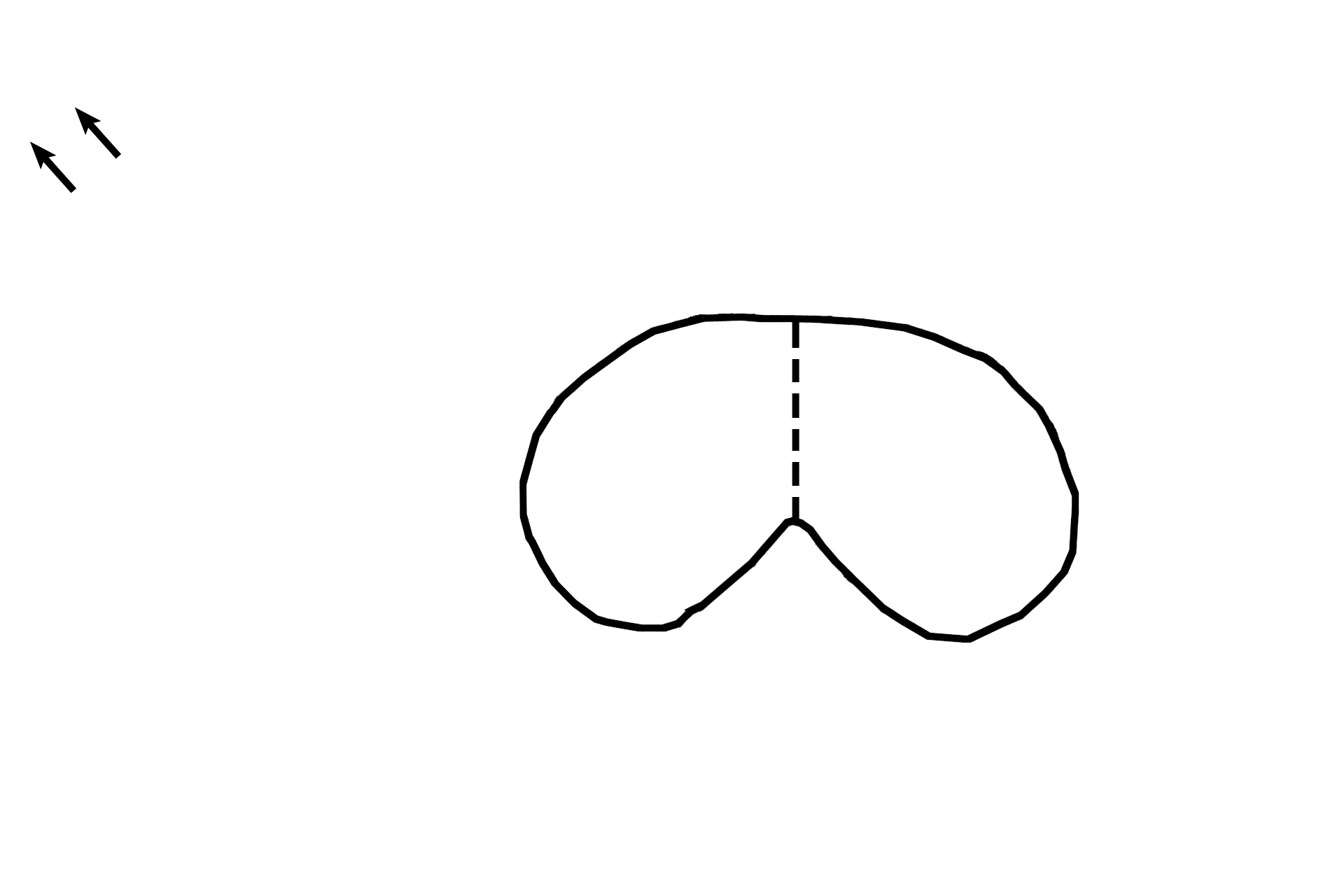 Corpora cavernosa > <p>The corpora cavernosa are paired cylinders of erectile tissue, composed of venous channels (cavernous spaces) and intervening trabeculae of connective tissue and smooth muscle.  The corpora are surrounded by a dense connective tissue layer called the tunica albuginea, that forms an incomplete central partition between the two cylinders. </p>
