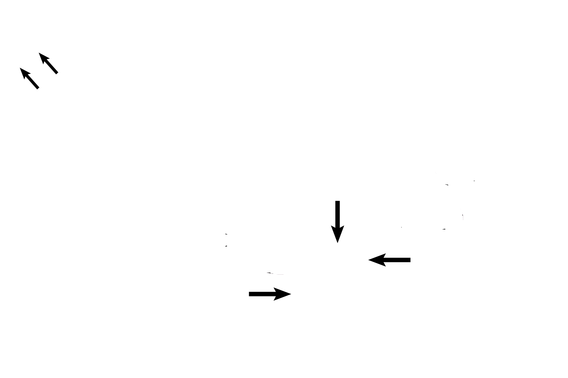  - Tunica albuginea <p>The corpus spongiosum is another cylinder of erectile tissue that lies in the ventral midline.  Its tunica albuginea is less dense than that surrounding the dorsal corpora, thus ensuring that the urethra it contains will not be occluded during ejaculation.  The glands of Littre are mucus-secreting glands that secrete into the urethra. </p>
