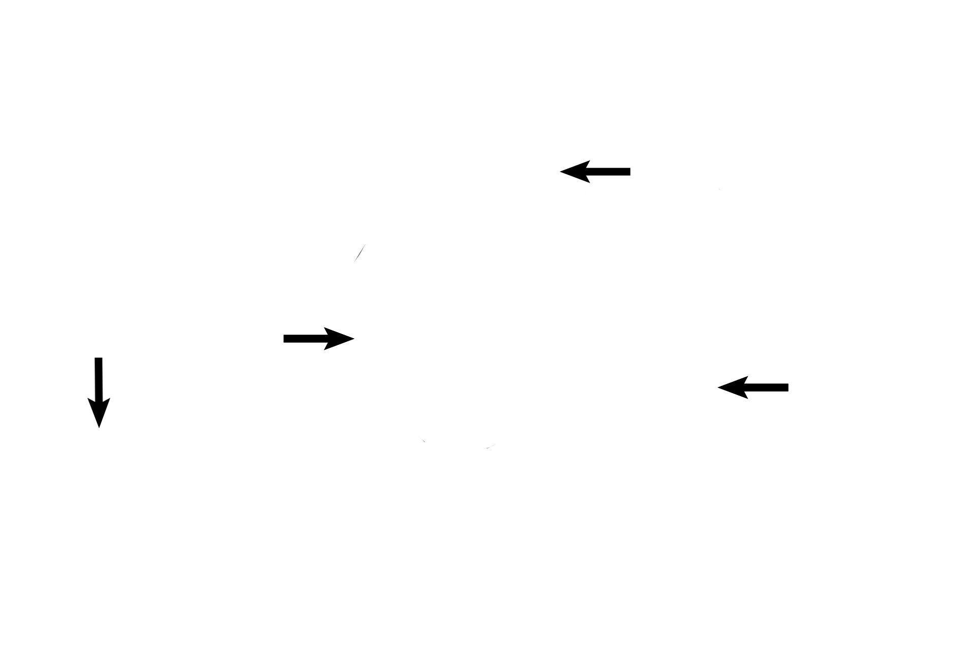 Tunica albuginea <p>The three corpora of the penis are shown here. The two corpora cavernosa are located dorsally with the tunica albuginea surrounding and separating them. The ventral corpus spongiosum contains the urethra and the glands of Littre that extend from it. 100x</p>
