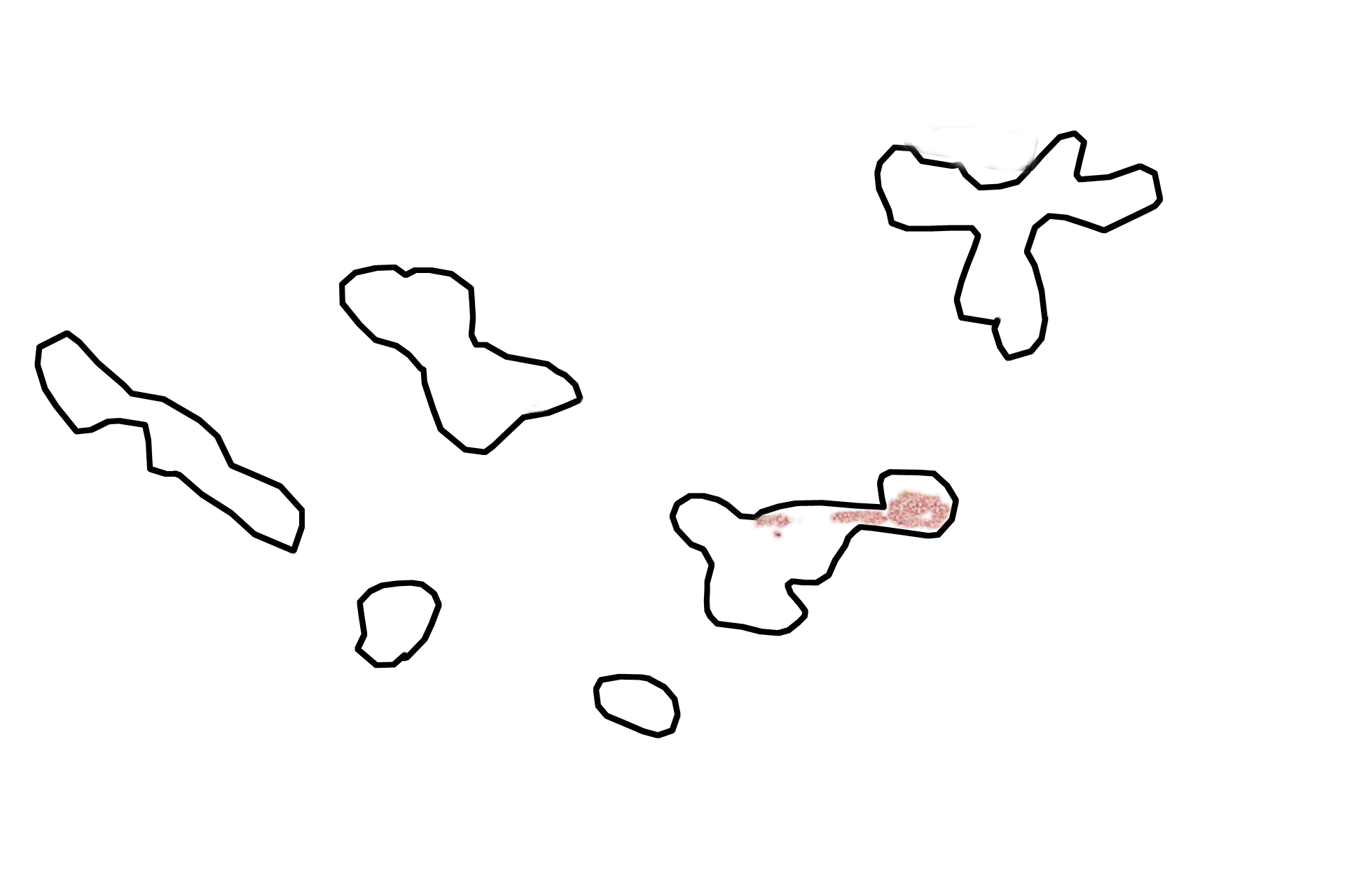 Cavernous spaces <p>The erectile tissue of a corpus cavernosum displays the blood-filled cavernous spaces and the trabeculae that separate them. The deep artery is visible, as is one of its branches, probably a helicine artery that supplies the cavernous spaces. 200x </p>
