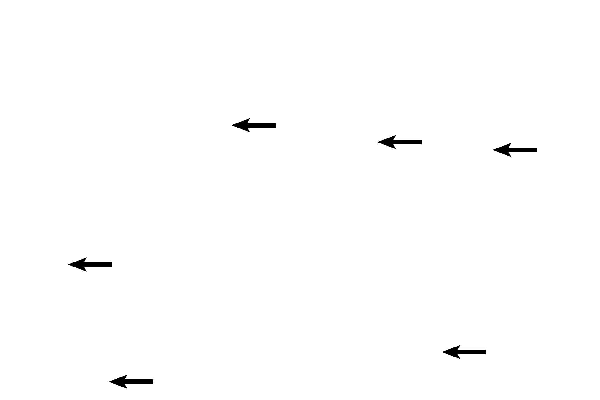  - Cavernous spaces <p>The urethra in the penis is primarily lined by pseudostratified or stratified columnar epithelia.  The epithelium changes to a stratified squamous in the fossa navicularis near the junction of the urethra with skin. Evaginations from the urethral epithelium continue as the mucus-secreting glands of Littre. 40x</p>
