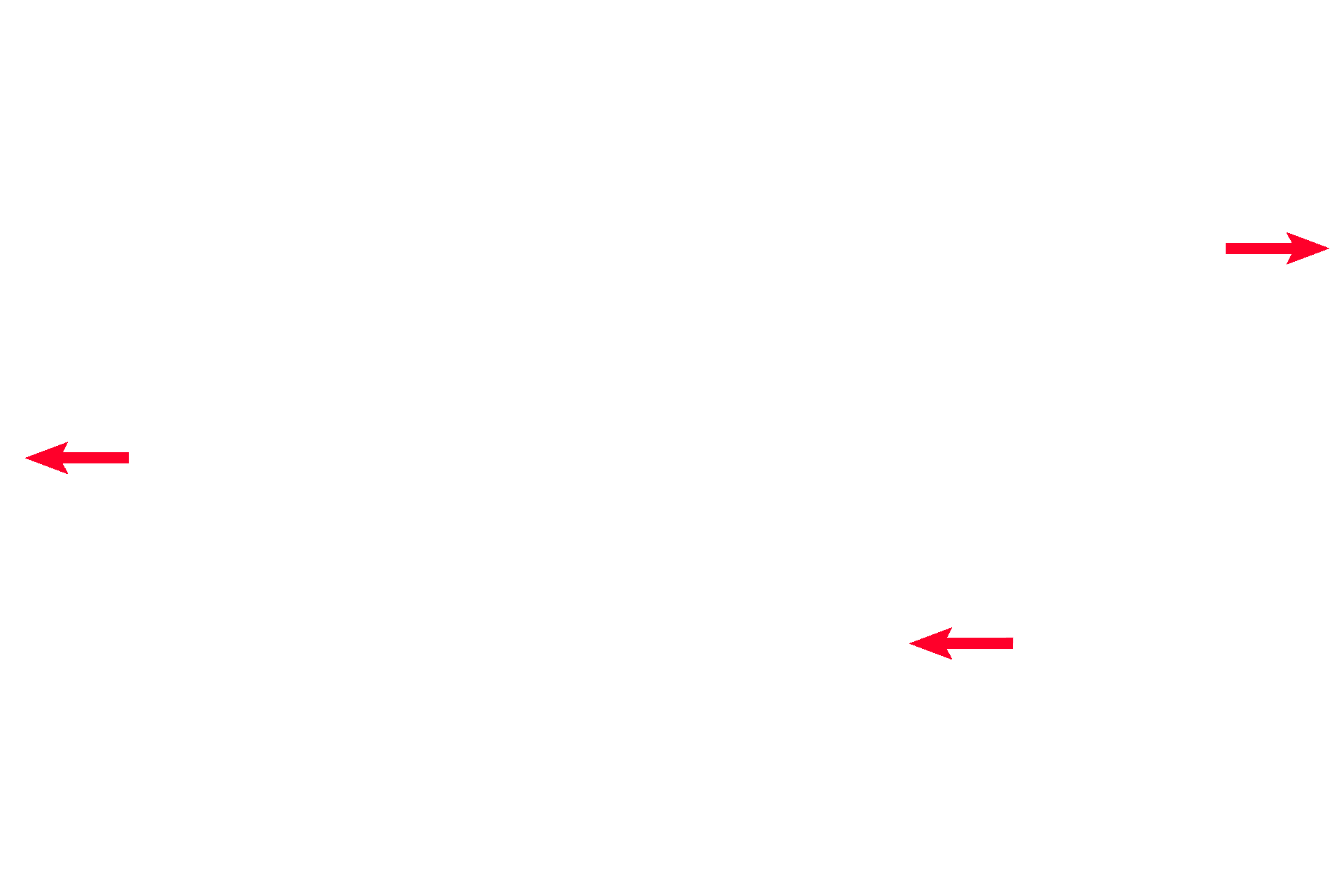 Nerves <p>Surrounding the ductus deferens is a sheath of connective tissue housing the testicular artery, the pampiniform plexus of veins and small peripheral nerves. The venous plexus serves as a heat exchanger to reduce the temperature of the incoming blood in the testicular artery. 100x </p>
