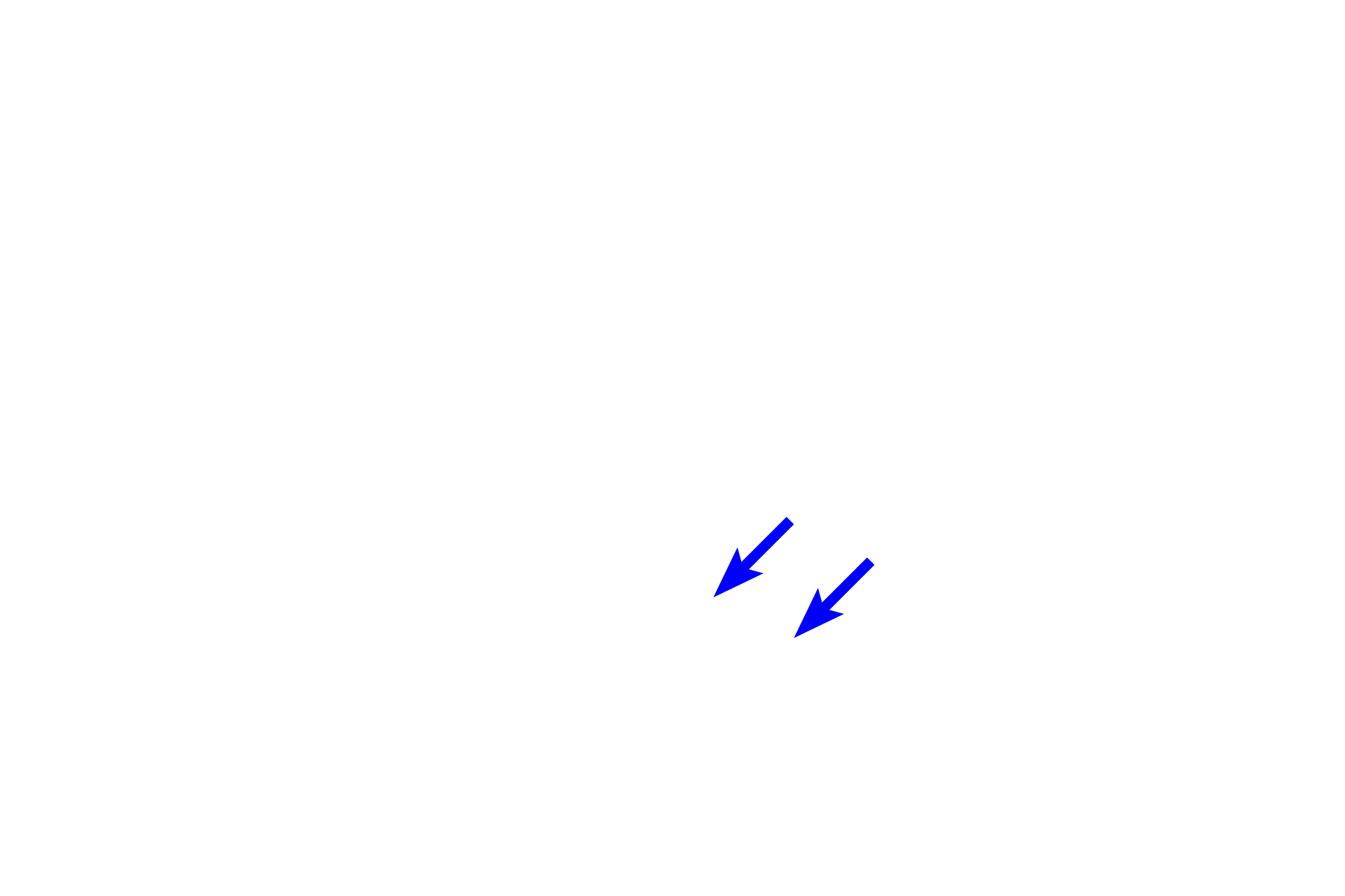  - Fibroblast <p>A wide variety of cells are present in connective tissue proper. Fibroblasts produce extracellular matrix (ground substance and fibers). Macrophages phagocytose foreign matter. Plasma cells and mast cells along with several other cell types, provide immunologic defense. Other cells, such as adipocytes (not illustrated), store fat.</p>
