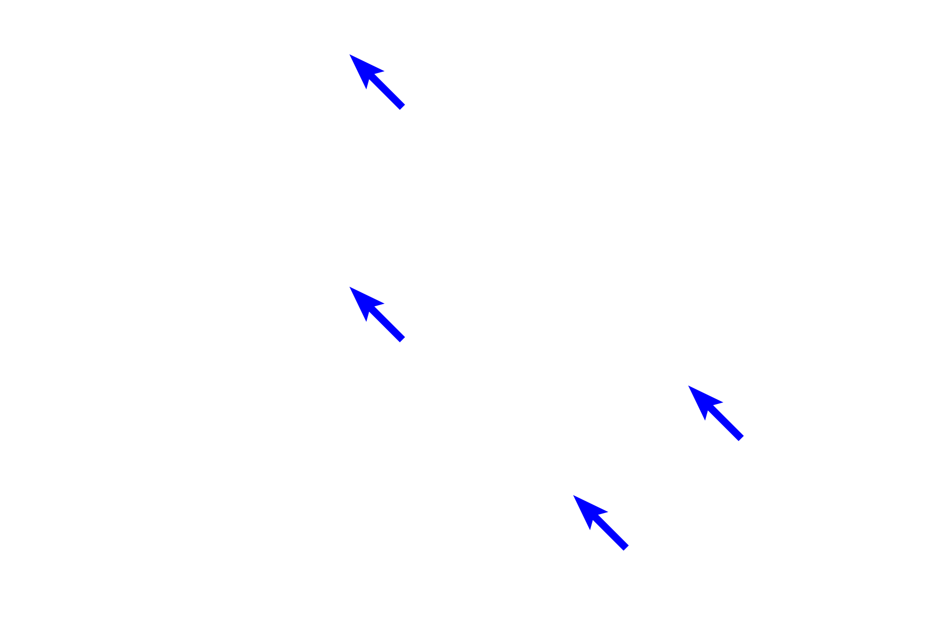 Adipocytes <p>Adipocytes, or fat cells, are non-motile resident cells filled with stored lipid. This centrally located lipid compresses the remaining cytoplasm to a thin, outer rim. Each heterochromatic nucleus is visible as a crescent on one side of the cell. These adipocytes, as well as adjacent glands, are surrounded by a loose connective tissue. 300x</p>
