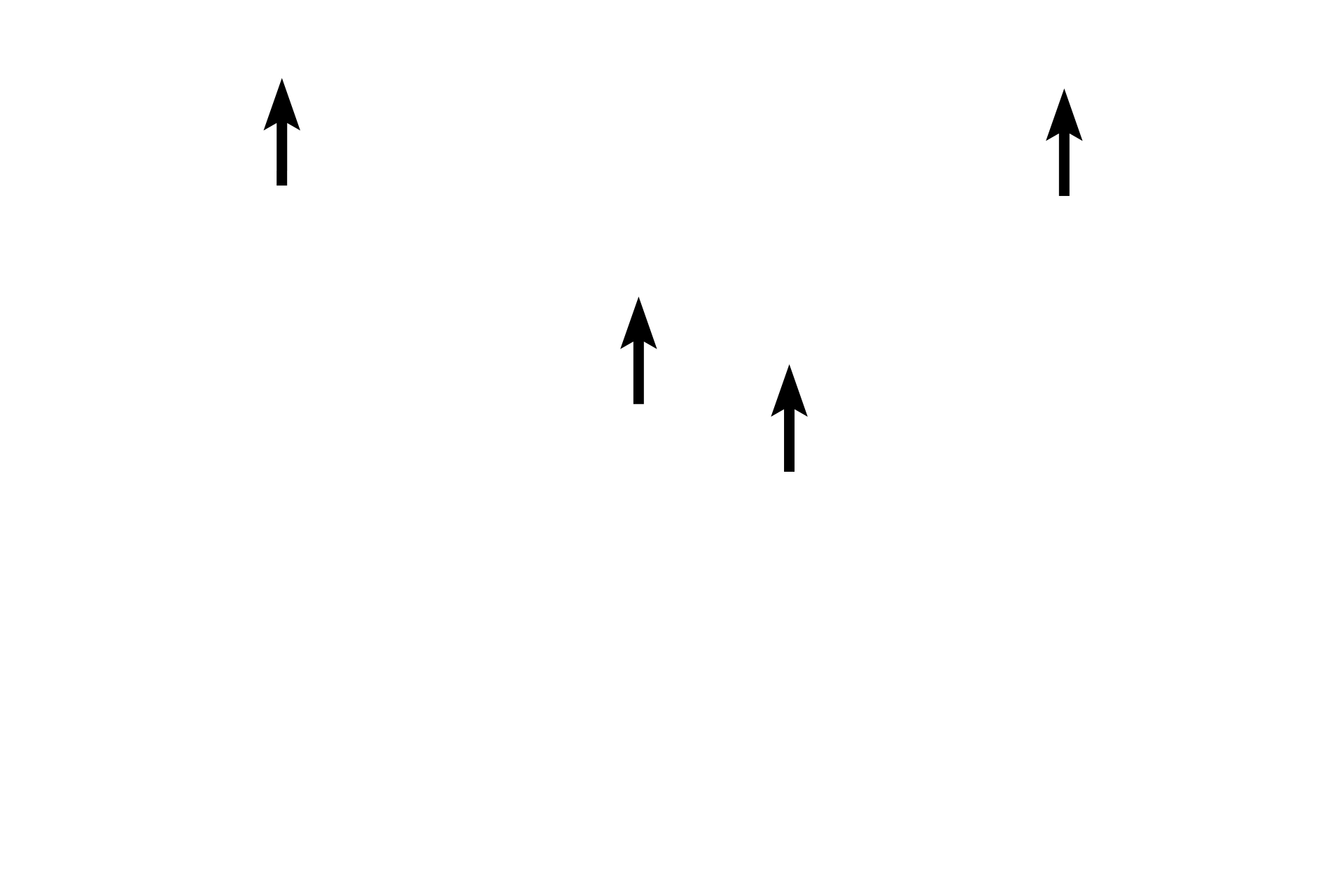 Adipocyte nuclei <p>Adipocytes are found individually or in small clusters in loose connective tissue. They can also form an entire tissue, called adipose connective tissue as seen here. The cells are surrounded by a stroma of loose connective tissue. Adipocytes contain a single large lipid droplet that compresses the nucleus and cytoplasm to the periphery of the cell. The lipid is extracted during tissue processing and, therefore, the cells appear empty. 400x</p>

