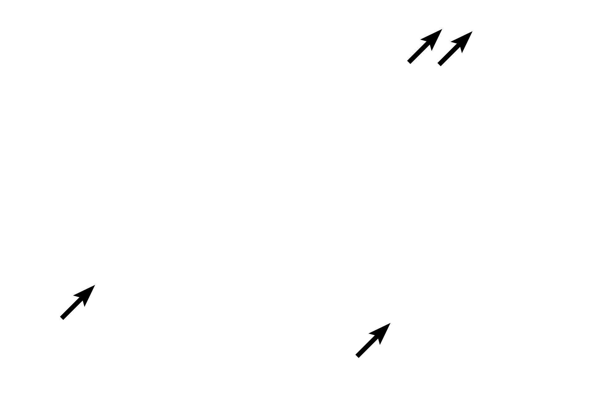 Active fibroblast nuclei <p>Adipocytes are found individually or in small clusters in loose connective tissue. They can also form an entire tissue, called adipose connective tissue as seen here. The cells are surrounded by a stroma of loose connective tissue. Adipocytes contain a single large lipid droplet that compresses the nucleus and cytoplasm to the periphery of the cell. The lipid is extracted during tissue processing and, therefore, the cells appear empty. 400x</p>
