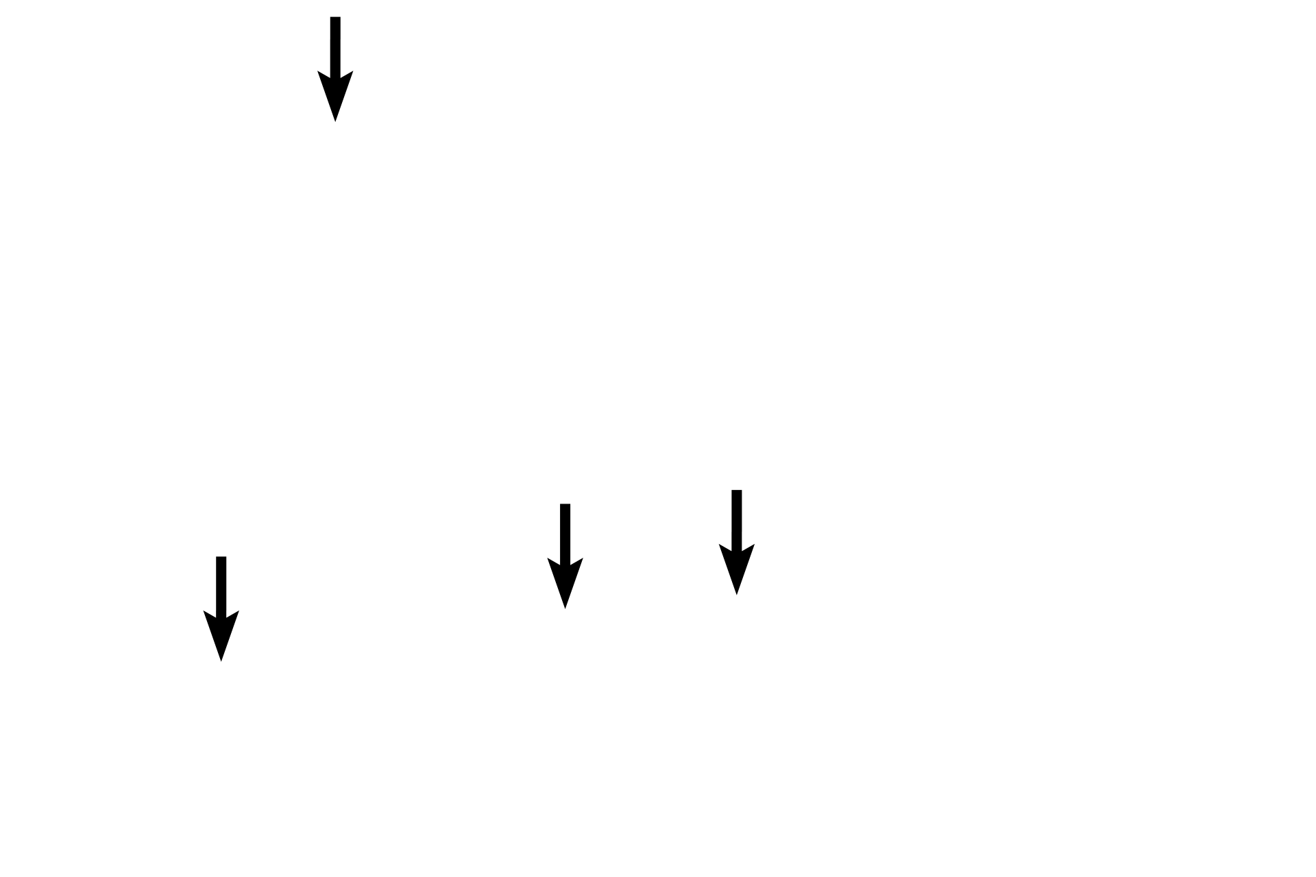 Capillaries <p>Adipocytes are found individually or in small clusters in loose connective tissue. They can also form an entire tissue, called adipose connective tissue as seen here. The cells are surrounded by a stroma of loose connective tissue. Adipocytes contain a single large lipid droplet that compresses the nucleus and cytoplasm to the periphery of the cell. The lipid is extracted during tissue processing and, therefore, the cells appear empty. 400x</p>
