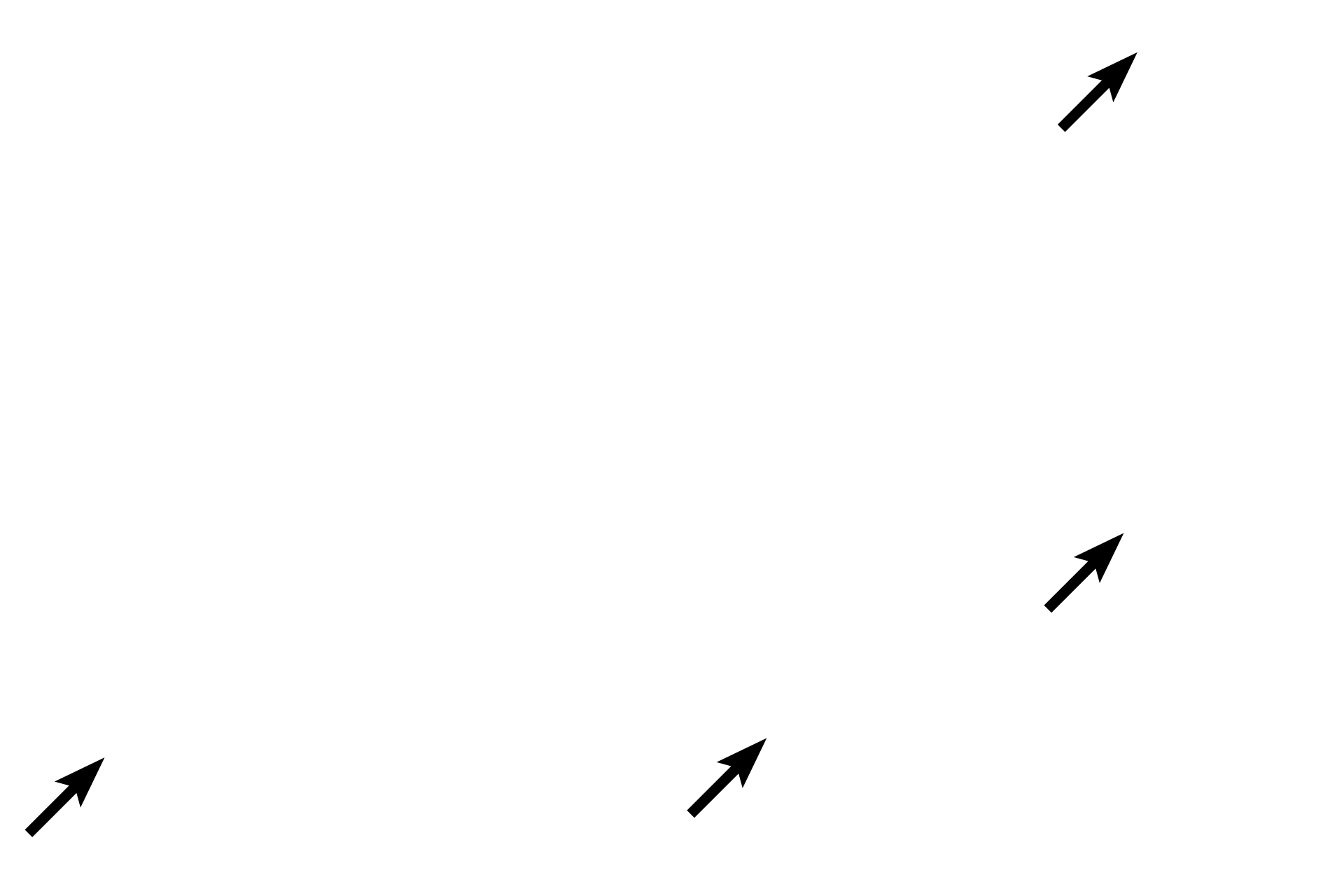 Collagen fibers <p>Adipocytes are found individually or in small clusters in loose connective tissue. They can also form an entire tissue, called adipose connective tissue as seen here. The cells are surrounded by a stroma of loose connective tissue. Adipocytes contain a single large lipid droplet that compresses the nucleus and cytoplasm to the periphery of the cell. The lipid is extracted during tissue processing and, therefore, the cells appear empty. 400x</p>
