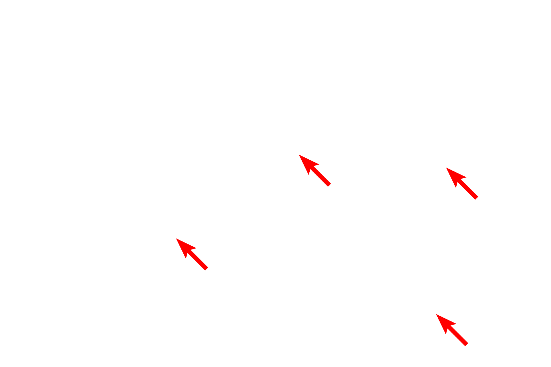 Collagen fibers <p>A small accumulation of adipocytes is seen here in a loose connective tissue. This tissue has been fixed with osmium tetroxide, which preserves the large lipid droplet and prevents it from being extracted during tissue preparation.  The reaction of osmium with the lipid produces the brown-black staining. 1000x</p>
