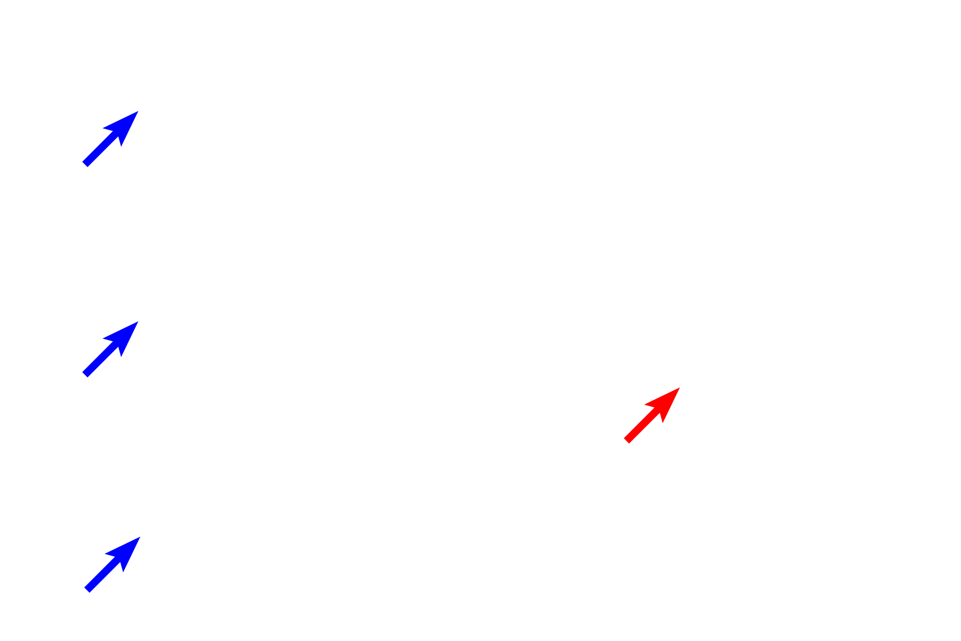 Nuclear indentation <p>Macrophages are the major phagocytic cell in connective tissue. They are derived from blood-borne monocytes (upper left) that migrate into the tissue (two lower left panels). The ultrastructure of a macrophage is shown on the right. Macrophage nuclei are oval-shaped and frequently indented, reflecting the cell’s origin from a monocyte. The pink cytoplasm, when visible, contains numerous lysosomes and phagocytosed material. 1000x (LM), 8000x (EM)</p>
