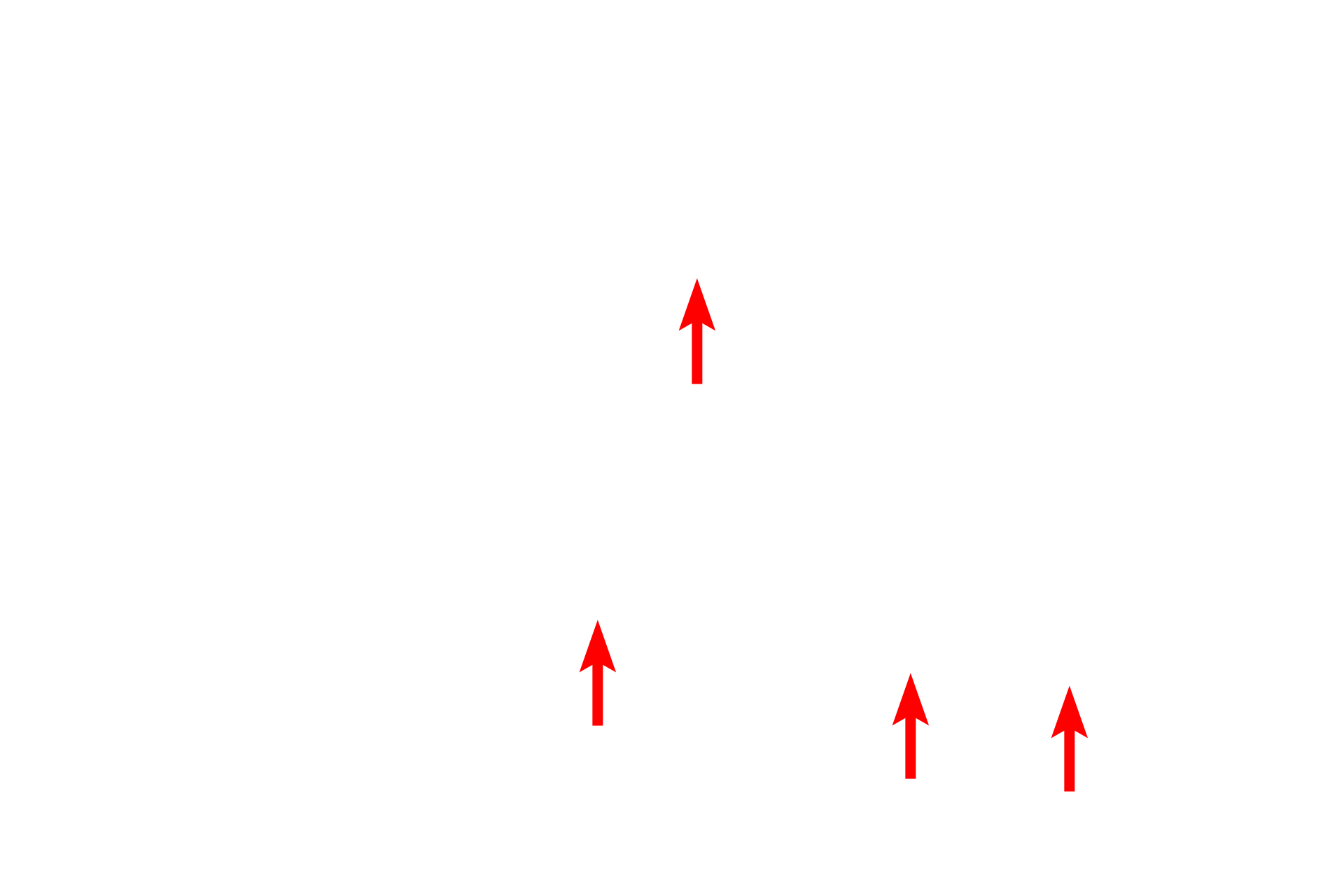 Lysosomes <p>Macrophages are the major phagocytic cell in connective tissue. They are derived from blood-borne monocytes (upper left) that migrate into the tissue (two lower left panels). The ultrastructure of a macrophage is shown on the right. Macrophage nuclei are oval-shaped and frequently indented, reflecting the cell’s origin from a monocyte. The pink cytoplasm, when visible, contains numerous lysosomes and phagocytosed material. 1000x (LM), 8000x (EM)</p>

