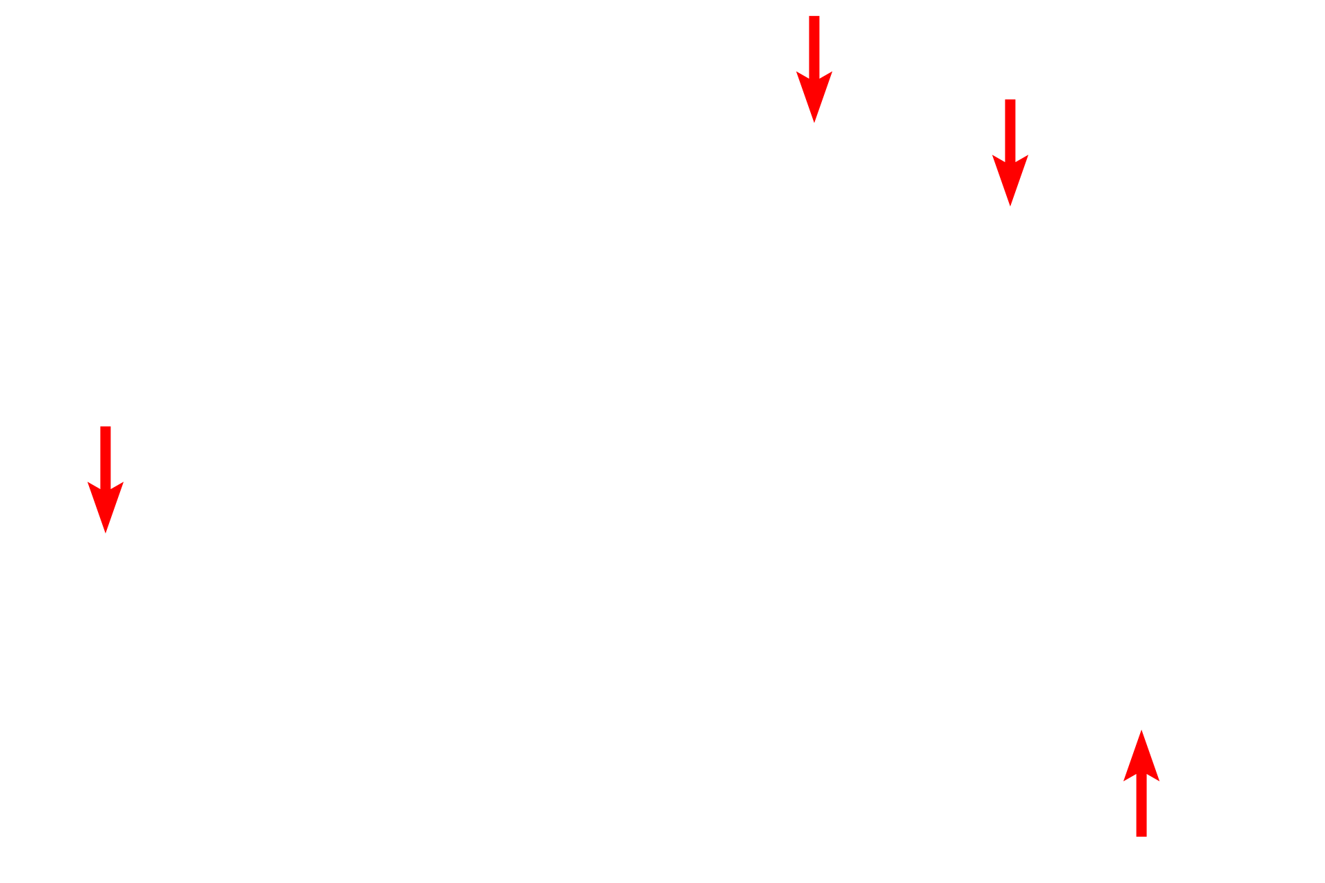 Folds and processes <p>The macrophage nucleus has a prominent indentation, reflective of its origin from monocytes.  The accumulations of heterochromatin are mostly located just beneath the nuclear envelope, a distribution referred to as marginated. Prominent folding and ruffling of the processes is also typically seen.  Numerous heterogeneous lysosomes are also visible. 7000x</p>
