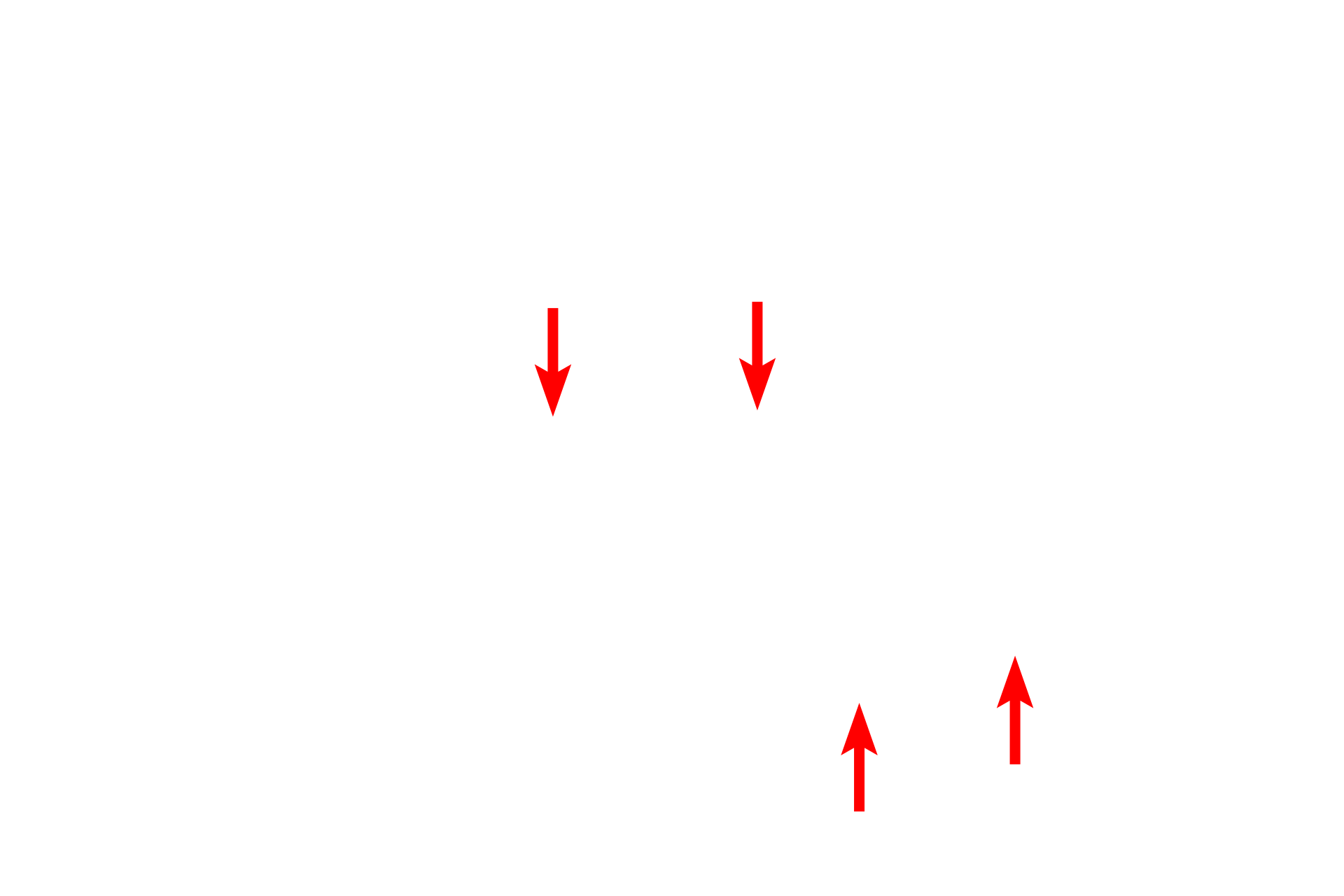 Marginal heterochromatin <p>The macrophage nucleus has a prominent indentation, reflective of its origin from monocytes.  The accumulations of heterochromatin are mostly located just beneath the nuclear envelope, a distribution referred to as marginated. Prominent folding and ruffling of the processes is also typically seen.  Numerous heterogeneous lysosomes are also visible. 7000x</p>
