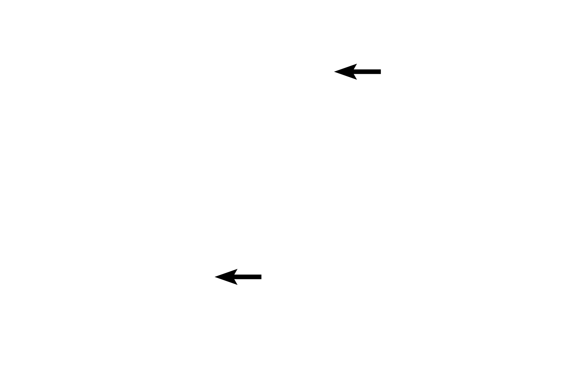 Connective tissue mast cells <p>Mast cells are produced in the bone marrow, enter the circulation and then become fixed, resident cells in connective tissue. These cells are spherical to oval-shaped with a centrally-located, spherical nucleus. Their cytoplasm is filled with numerous granules that contain mediators of the inflammatory response. Two major classes of mast cells are recognized, connective tissue mast cells which are located throughout the body and mucosal mast cells that a present in the respiratory and digestive systems.  Masts cells are related, but not identical, to basophils. 1000x</p>
