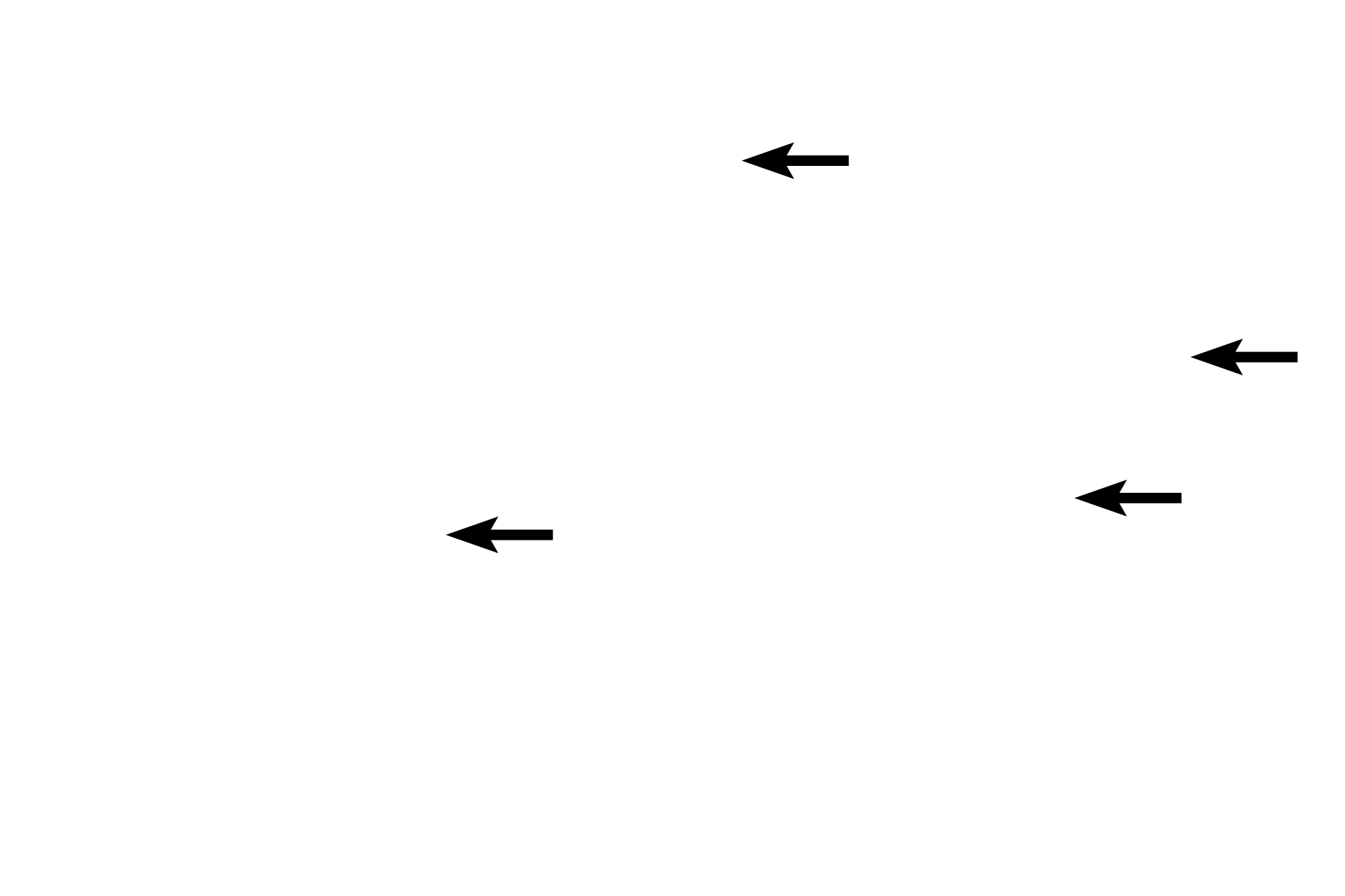 Granules > <p>Mast cell granules are heterogeneous in size and content. Connective tissue mast cell granules contain heparin and histamine as well as proteases, chymase and tryptase.  Mucosal mast cell granules contain tryptase only along with heparin and histamine.  Heparin is a heavily sulfated proteoglycan that stains metachromatically with dyes like trypan blue.  With H & E staining, the granules stain mostly purplish-red.</p>
