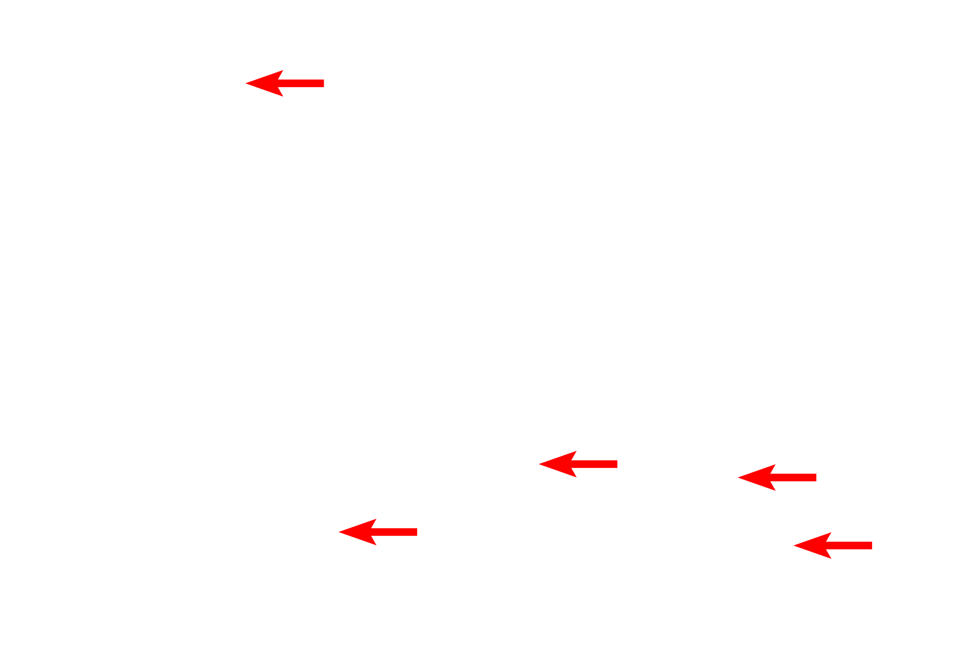 Metachromatic granules > <p>Mast cell granules exhibit metachromasia, due to their proteoglycan content. Metachromatic staining results when cellular structures with abundant polyanions, e.g., sulfate groups, are stained with a basic dye, such as toluidine blue. Dye molecules bind in close proximity and form aggregates having different absorptive properties from the single dye molecule, thus producing a different color.  Note how the color of the granules is purple in contrast to the non-metachromatic blue staining of the other tissue elements.</p>
