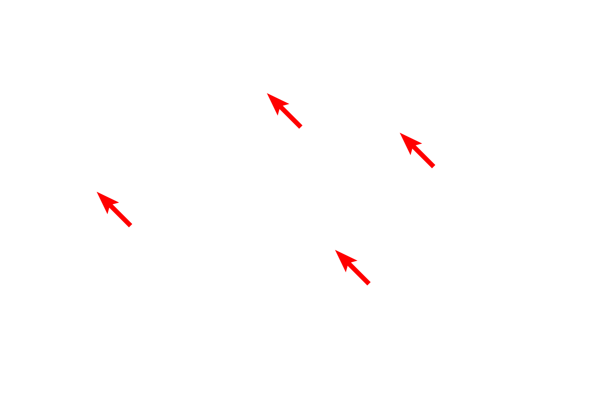 Fibroblast nuclei <p>Active fibroblasts are resident cells found in connective tissues. Their nuclei are euchromatic and elongated. This toluidine blue stain of loose connective tissue beneath an epithelium demonstrates the pale-staining collagen fibers and heavily stained elastic fibers. Blood vessels are also visible. 1000x</p>

