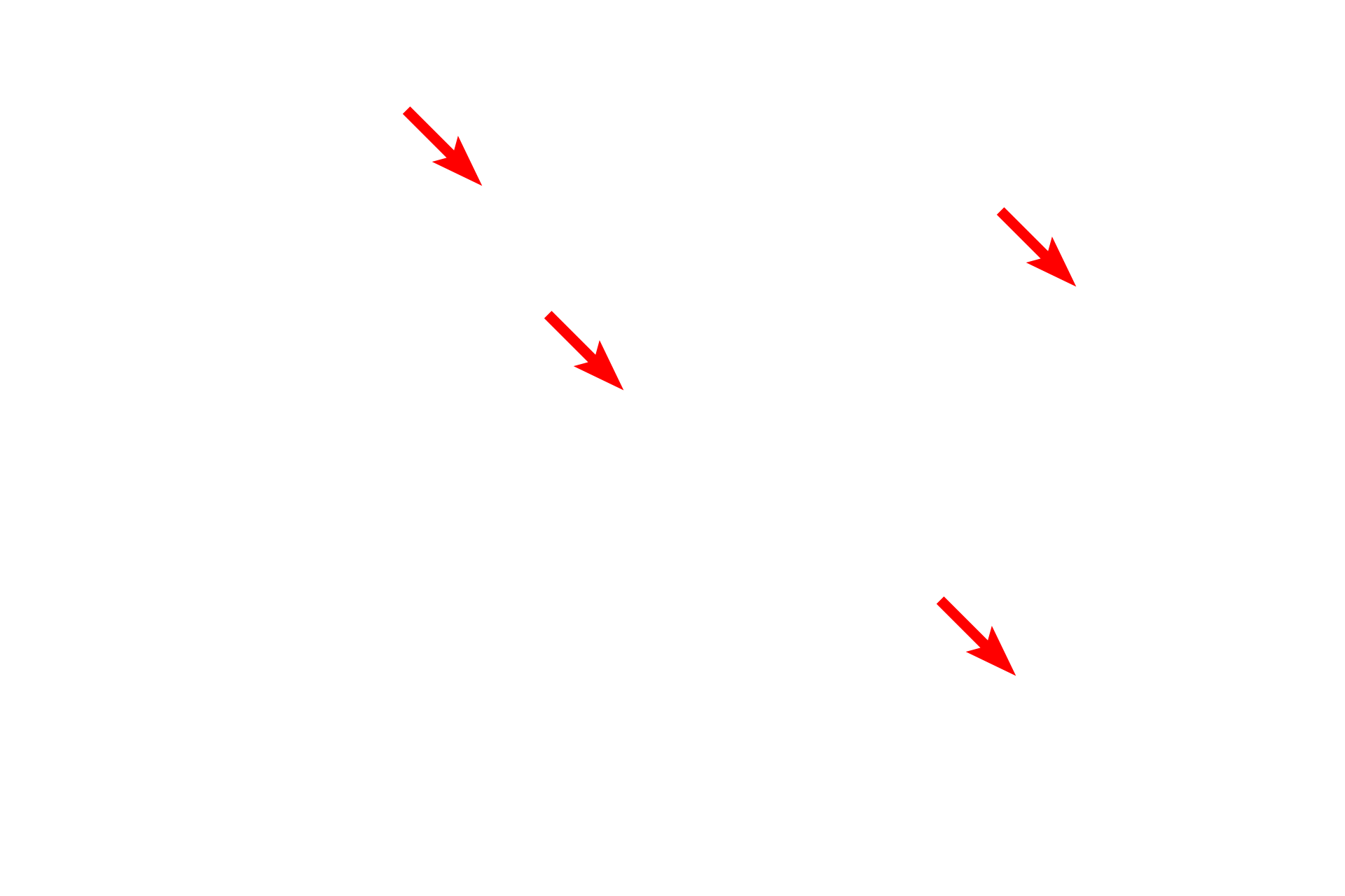 Elastic fibers <p>Active fibroblasts are resident cells found in connective tissues. Their nuclei are euchromatic and elongated. This toluidine blue stain of loose connective tissue beneath an epithelium demonstrates the pale-staining collagen fibers and heavily stained elastic fibers. Blood vessels are also visible. 1000x</p>

