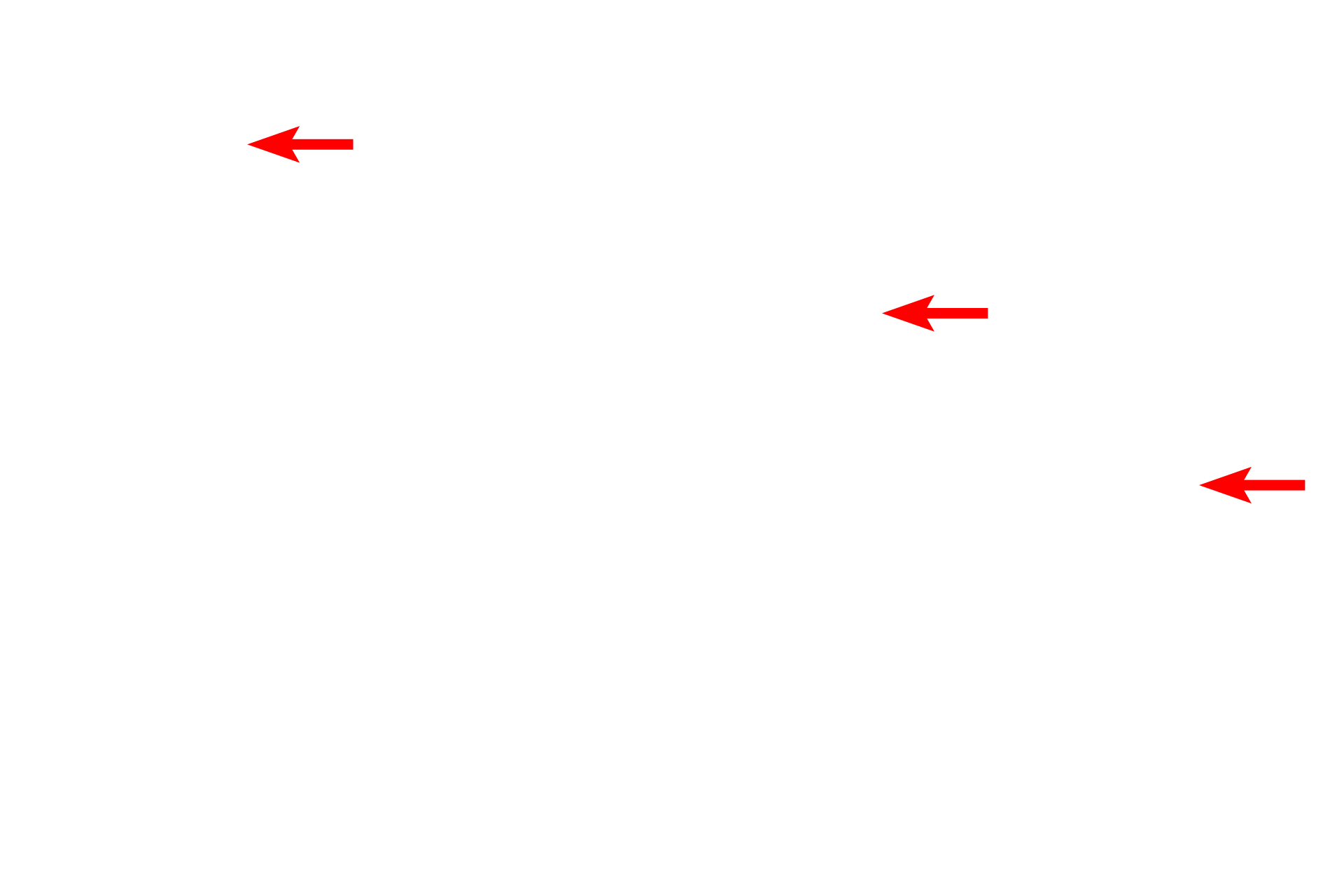 Collagen fibrils - cross section <p>The cytoplasm of an active fibroblast is resolved better with the electron microscope. This cell has a euchromatic nucleus with a prominent nucleolus.  The cell is surrounded by abundant collagen fibrils that are cut in both longitudinal and cross section. 8000x</p>
