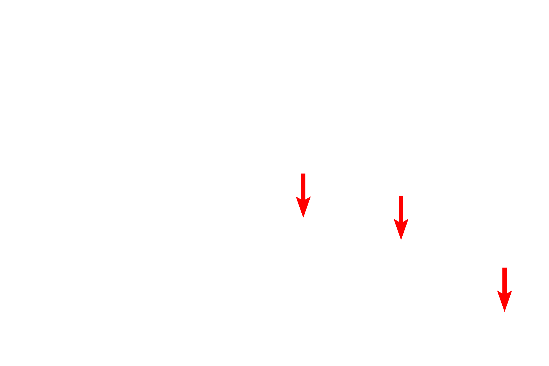 Fibroblast nuclei <p>This electron micrograph of dense irregular connective tissue shows active fibroblasts surrounded by collagen and elastic fibers. Active fibroblasts have euchromatic nuclei and in this tissue they have thin cell processes. 5000x</p>
