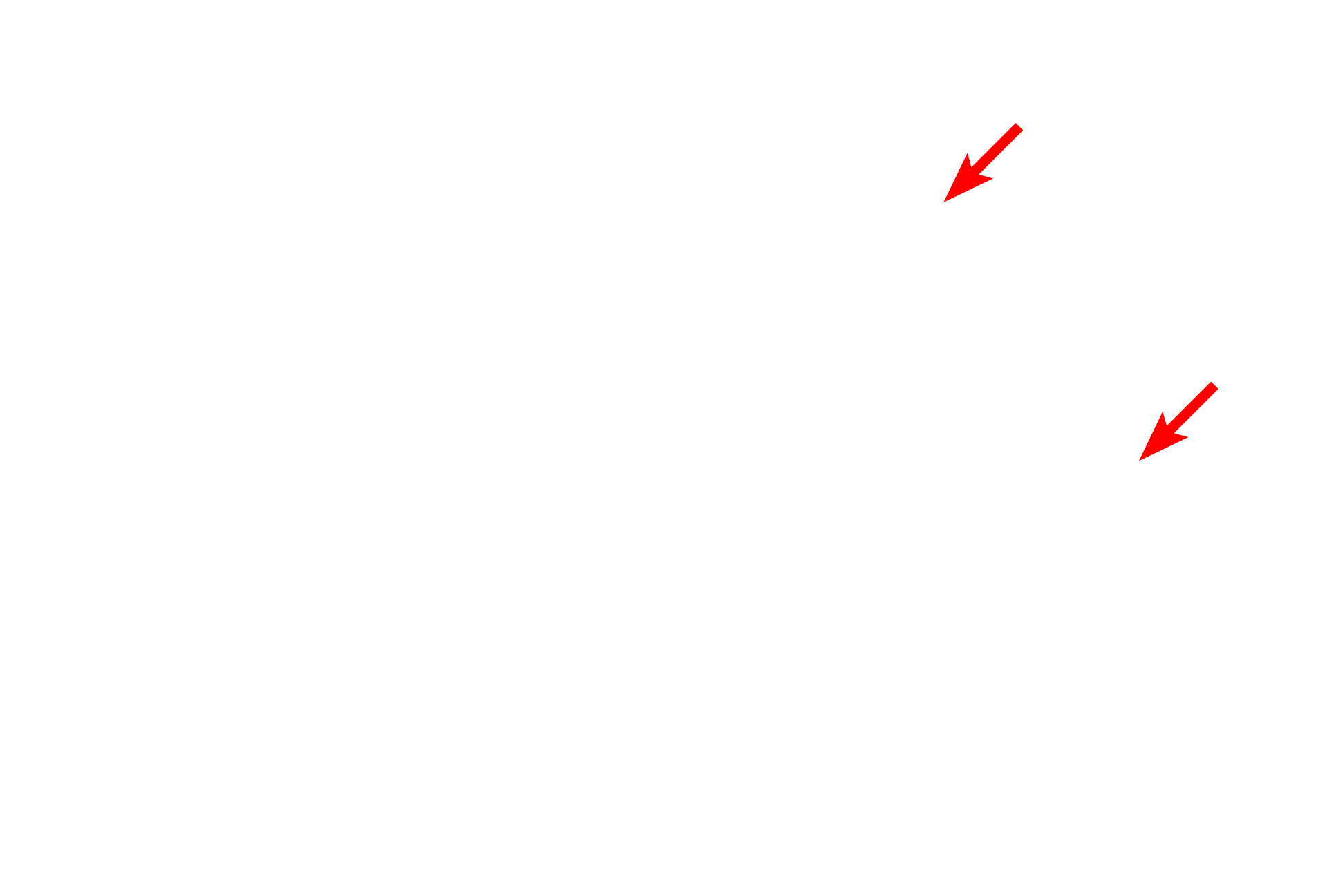 Elastic fibers > <p>Elastic fibers are composed of different proteins than collagen fibers and stain with greater electron density.</p>
