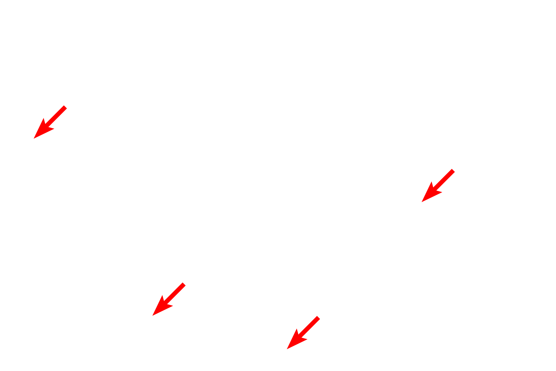 Collagen fibers <p>This electron micrograph of dense irregular connective tissue shows active fibroblasts surrounded by collagen and elastic fibers. Active fibroblasts have euchromatic nuclei and in this tissue they have thin cell processes. 5000x</p>
