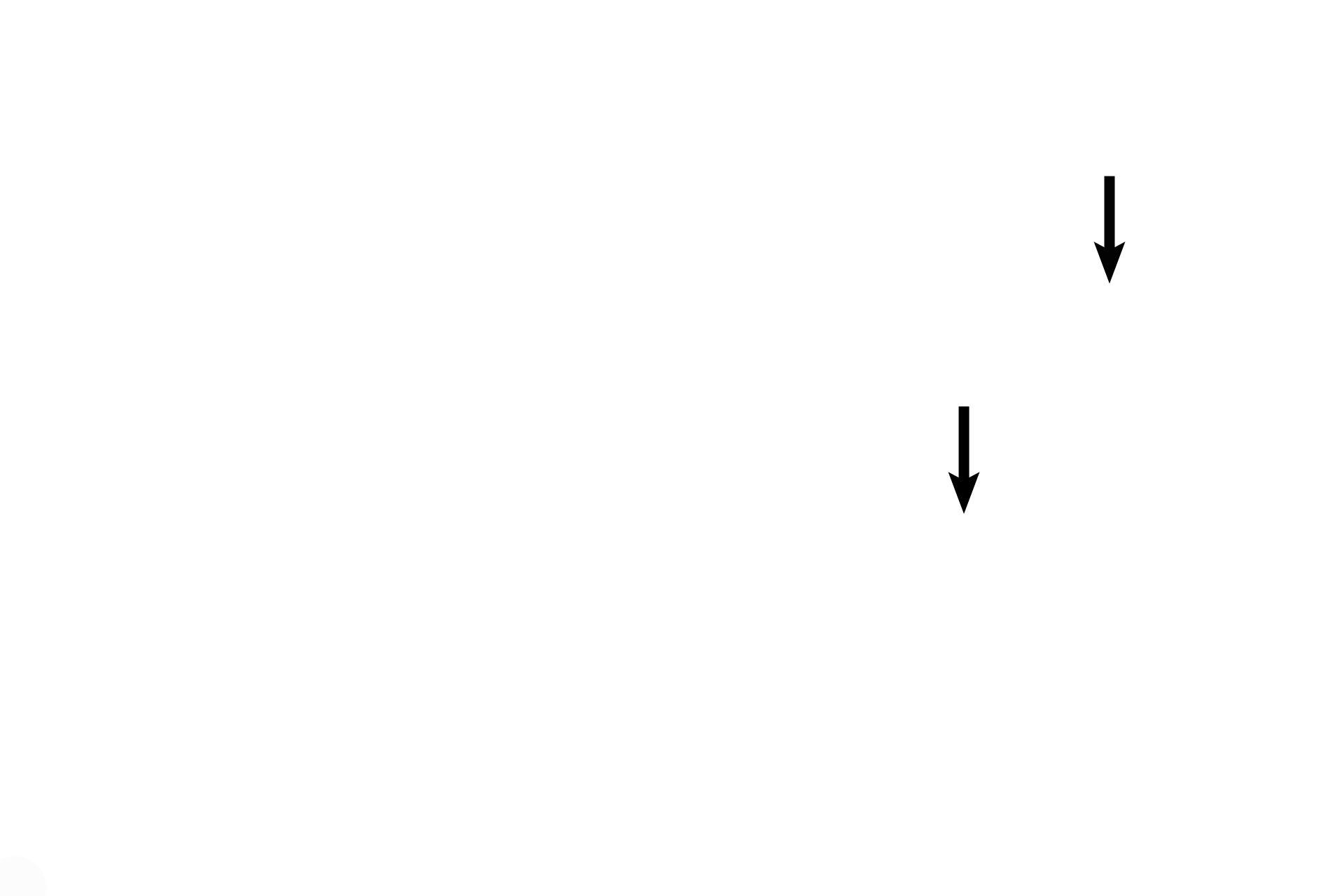 Bronchial vessels > <p>Branches of  bronchial arteries and veins supply the walls of respiratory passageways. Therefore, these vessels lie within and are smaller than the wall of the passageway.</p>
