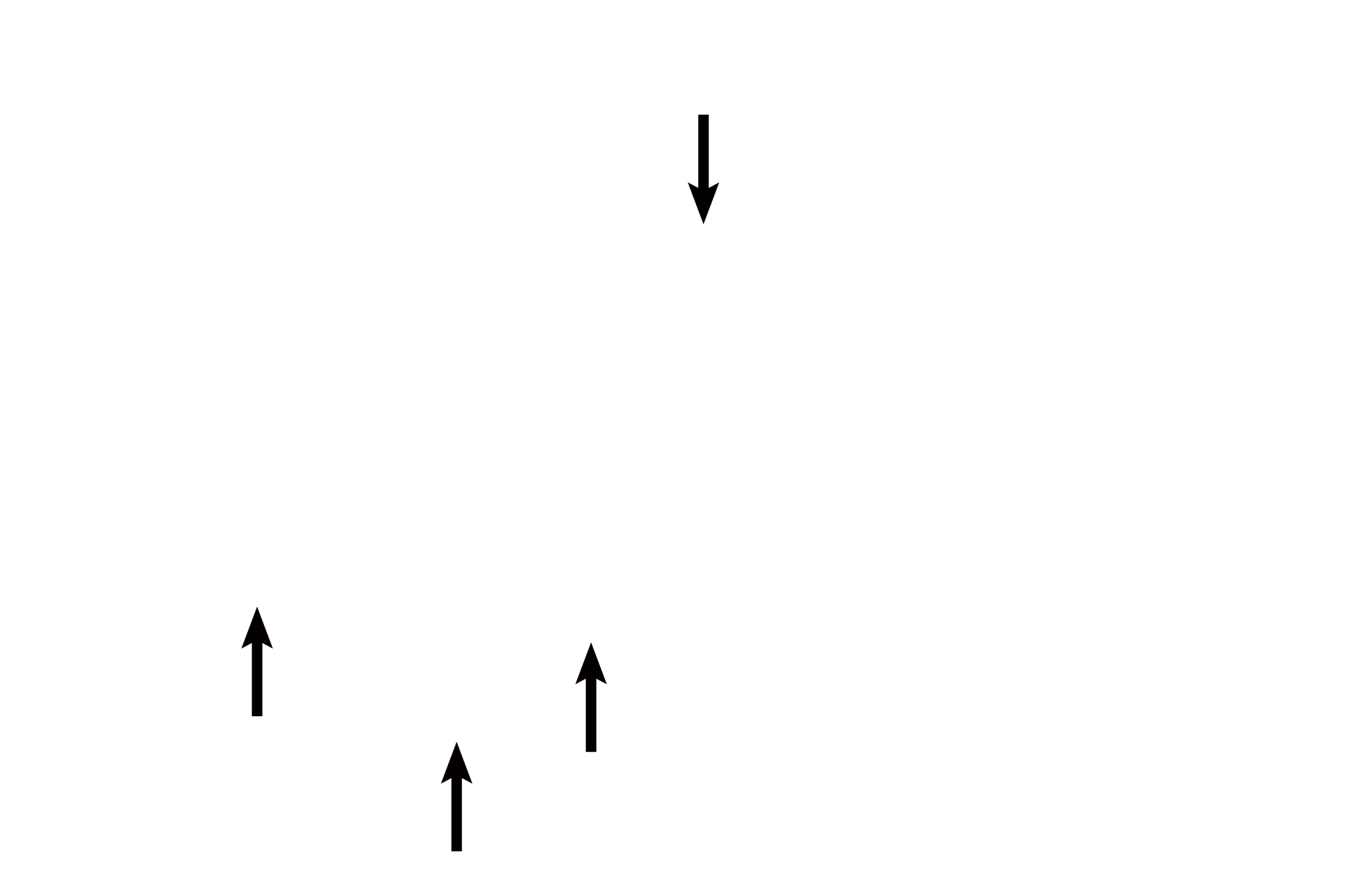 Bronchial vessels      <p>In order to supply tissues that form the walls of respiratory passageways, bronchial vessels must lie within the wall, making their diameter smaller than the thickness of that wall. 200x</p>
