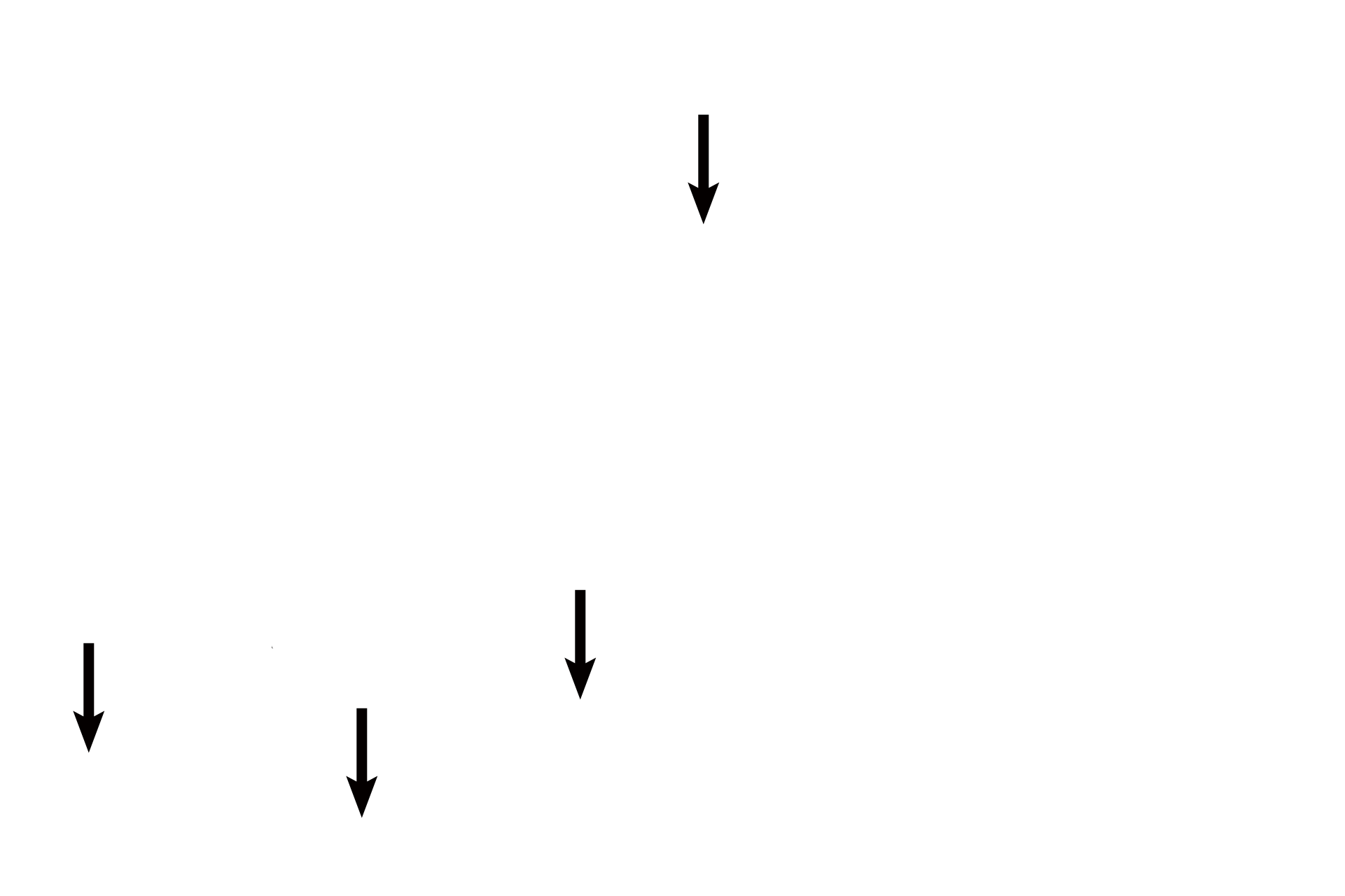 Macrophages <p>In order to supply tissues that form the walls of respiratory passageways, bronchial vessels must lie within the wall, making their diameter smaller than the thickness of that wall. 200x</p>
