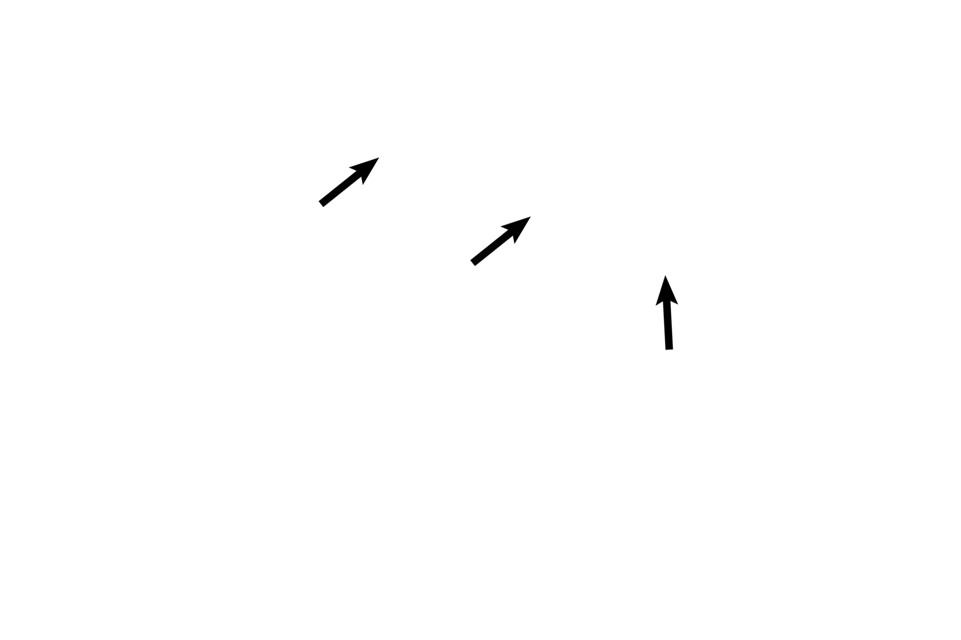 Pulmonary vein <p>Pulmonary veins carry oxygenated blood from the pulmonary capillaries back to the left atrium. These vessels do not accompany the smaller respiratory passageways; instead, they travel alone, frequently seen in the connective tissue septa that subdivide the lung. 100x</p>
