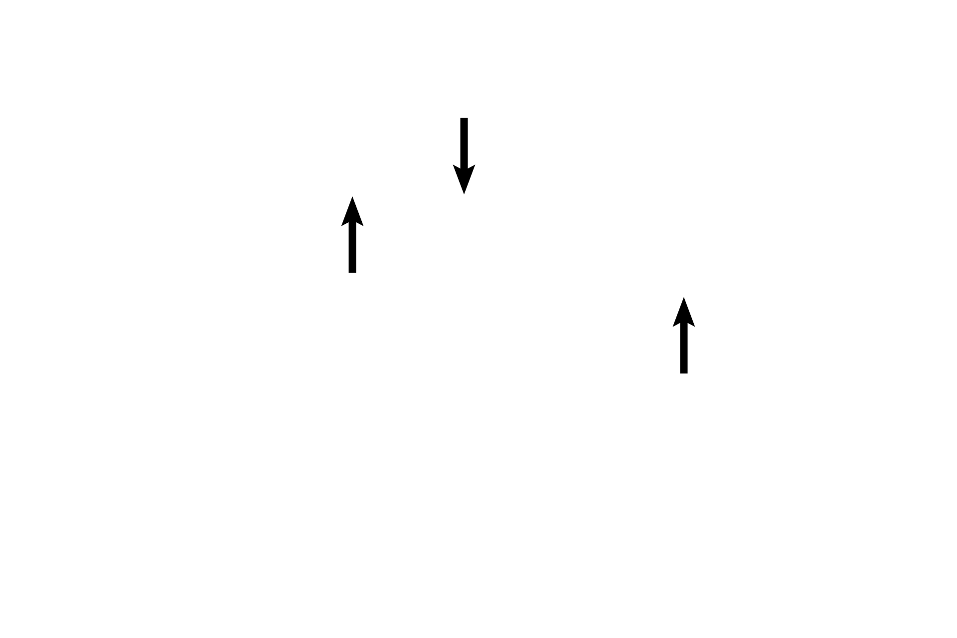 Connective tissue septum <p>Pulmonary veins carry oxygenated blood from the pulmonary capillaries back to the left atrium. These vessels do not accompany the smaller respiratory passageways; instead, they travel alone, frequently seen in the connective tissue septa that subdivide the lung. 100x</p>
